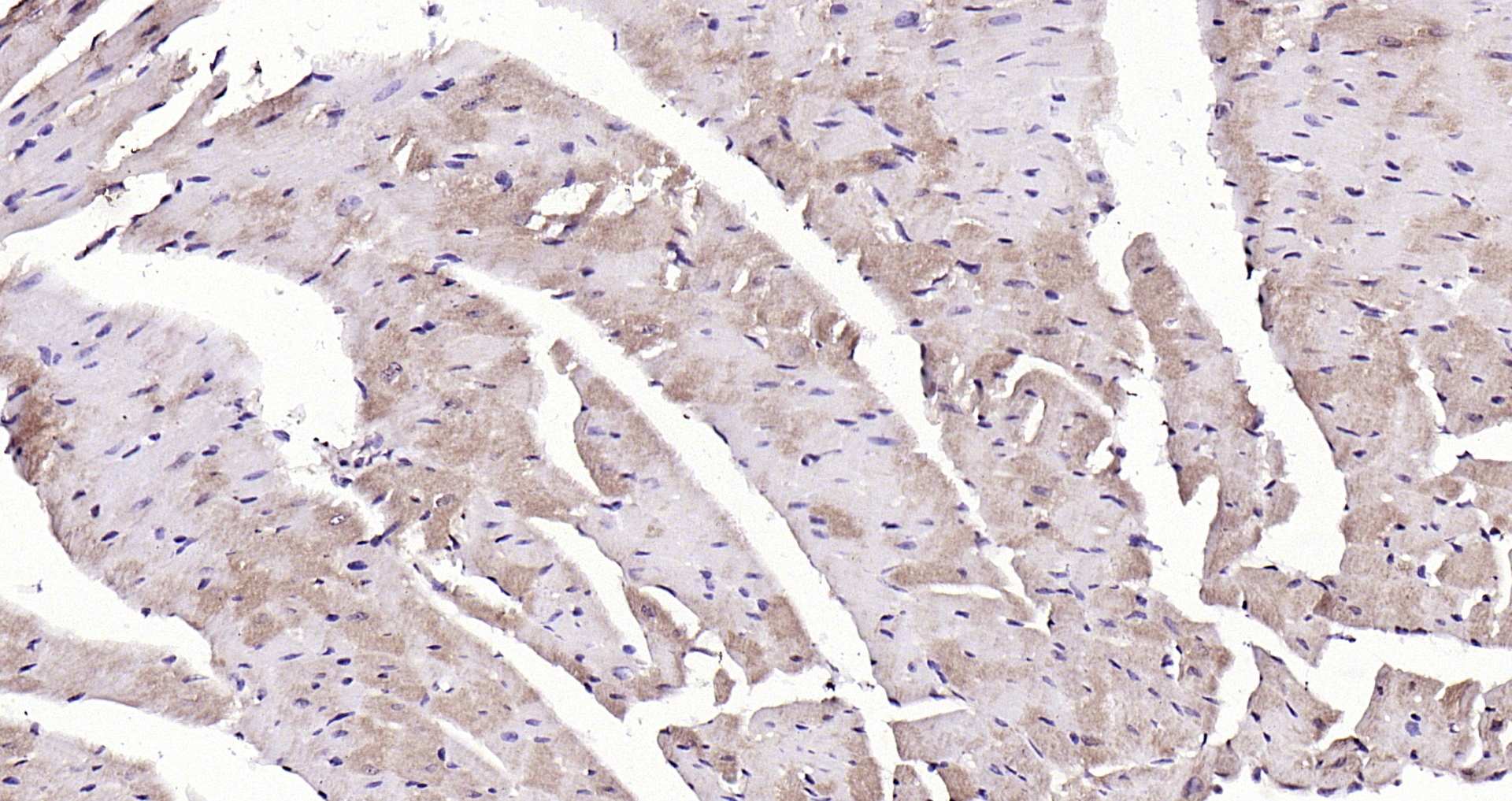 Paraformaldehyde-fixed, paraffin embedded Mouse heart; Antigen retrieval by boiling in sodium citrate buffer (pH6.0) for 15min; Block endogenous peroxidase by 3% hydrogen peroxide for 20 minutes; Blocking buffer (normal goat serum) at 37°C for 30min; Antibody incubation with LATS1/2 Polyclonal Antibody, Unconjugated (bs-4081R) at 1:200 overnight at 4°C, DAB staining.