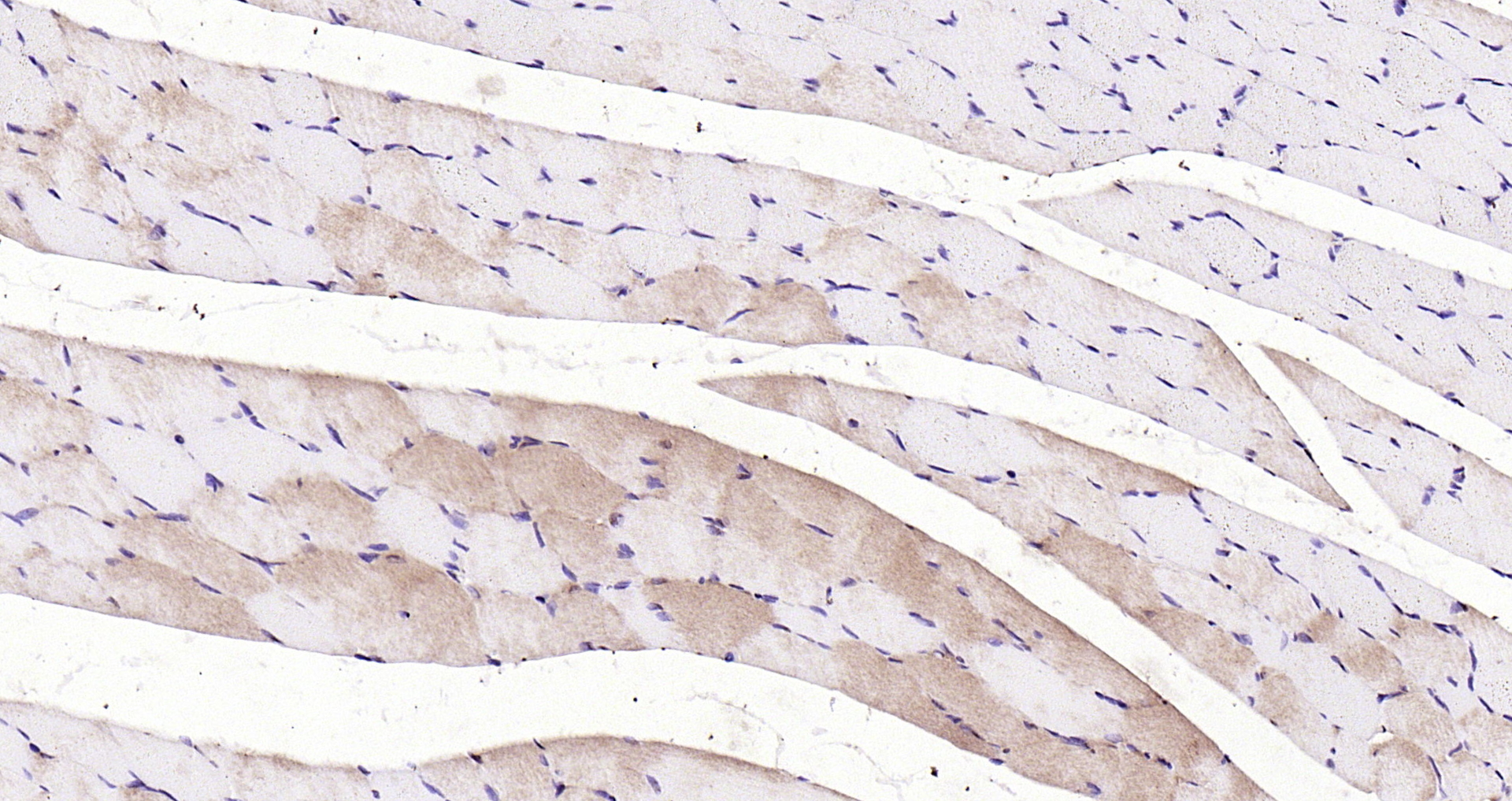 Paraformaldehyde-fixed, paraffin embedded Rat muscle; Antigen retrieval by boiling in sodium citrate buffer (pH6.0) for 15min; Block endogenous peroxidase by 3% hydrogen peroxide for 20 minutes; Blocking buffer (normal goat serum) at 37°C for 30min; Antibody incubation with LATS1/2 Polyclonal Antibody, Unconjugated (bs-4081R) at 1:200 overnight at 4°C, DAB staining.