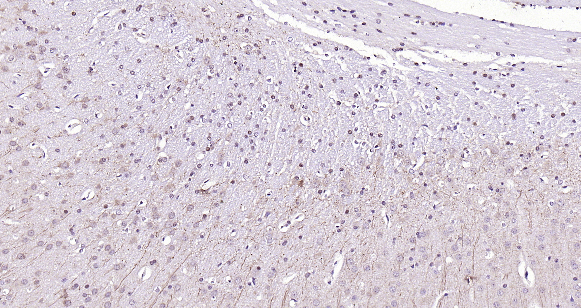 Paraformaldehyde-fixed, paraffin embedded Rat brain; Antigen retrieval by boiling in sodium citrate buffer (pH6.0) for 15min; Block endogenous peroxidase by 3% hydrogen peroxide for 20 minutes; Blocking buffer (normal goat serum) at 37°C for 30min; Antibody incubation with LATS1/2 Polyclonal Antibody, Unconjugated (bs-4081R) at 1:200 overnight at 4°C, DAB staining.