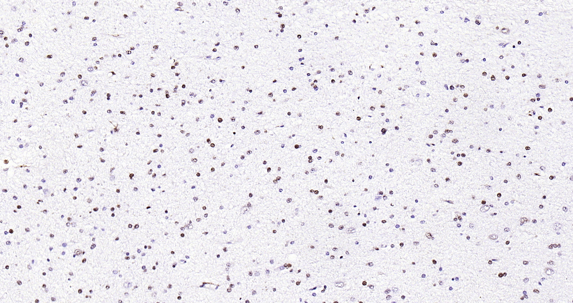 Paraformaldehyde-fixed, paraffin embedded Human brain; Antigen retrieval by boiling in sodium citrate buffer (pH6.0) for 15min; Block endogenous peroxidase by 3% hydrogen peroxide for 20 minutes; Blocking buffer (normal goat serum) at 37°C for 30min; Antibody incubation with H2AFX (8C5) Monoclonal Antibody, Unconjugated (bsm-51222M) at 1:200 overnight at 4°C, DAB staining.