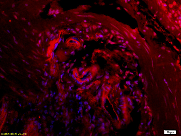 Formalin-fixed and paraffin embedded rat colitis tissue labeled with Anti CTHRC1 Polyclonal Antibody, Unconjugated (bs-5882R) at 1:200 followed by conjugation to the secondary antibody Goat Anti-Rabbit IgG, Cy3 conjugated(bs-0295G-Cy3)used at 1:200 dilution for 40 minutes at 37°C and DAPI staining