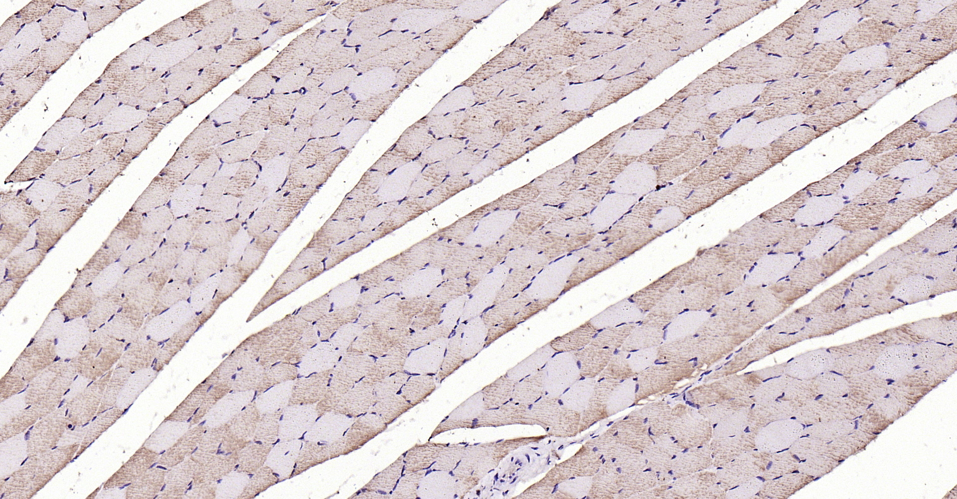 Paraformaldehyde-fixed, paraffin embedded Rat muscle; Antigen retrieval by boiling in sodium citrate buffer (pH6.0) for 15min; Block endogenous peroxidase by 3% hydrogen peroxide for 20 minutes; Blocking buffer (normal goat serum) at 37°C for 30min; Antibody incubation with LIFR/CD118 Polyclonal Antibody, Unconjugated (bs-1458R) at 1:200 overnight at 4°C, DAB staining. Paraformaldehyde-fixed, paraffin embedded Rat muscle; Antigen retrieval by boiling in sodium citrate buffer (pH6.0) for 15min; Block endogenous peroxidase by 3% hydrogen peroxide for 20 minutes; Blocking buffer (normal goat serum) at 37°C for 30min; Antibody incubation with LIFR/CD118 Polyclonal Antibody, Unconjugated (bs-1458R) at 1:200 overnight at 4°C, DAB staining.