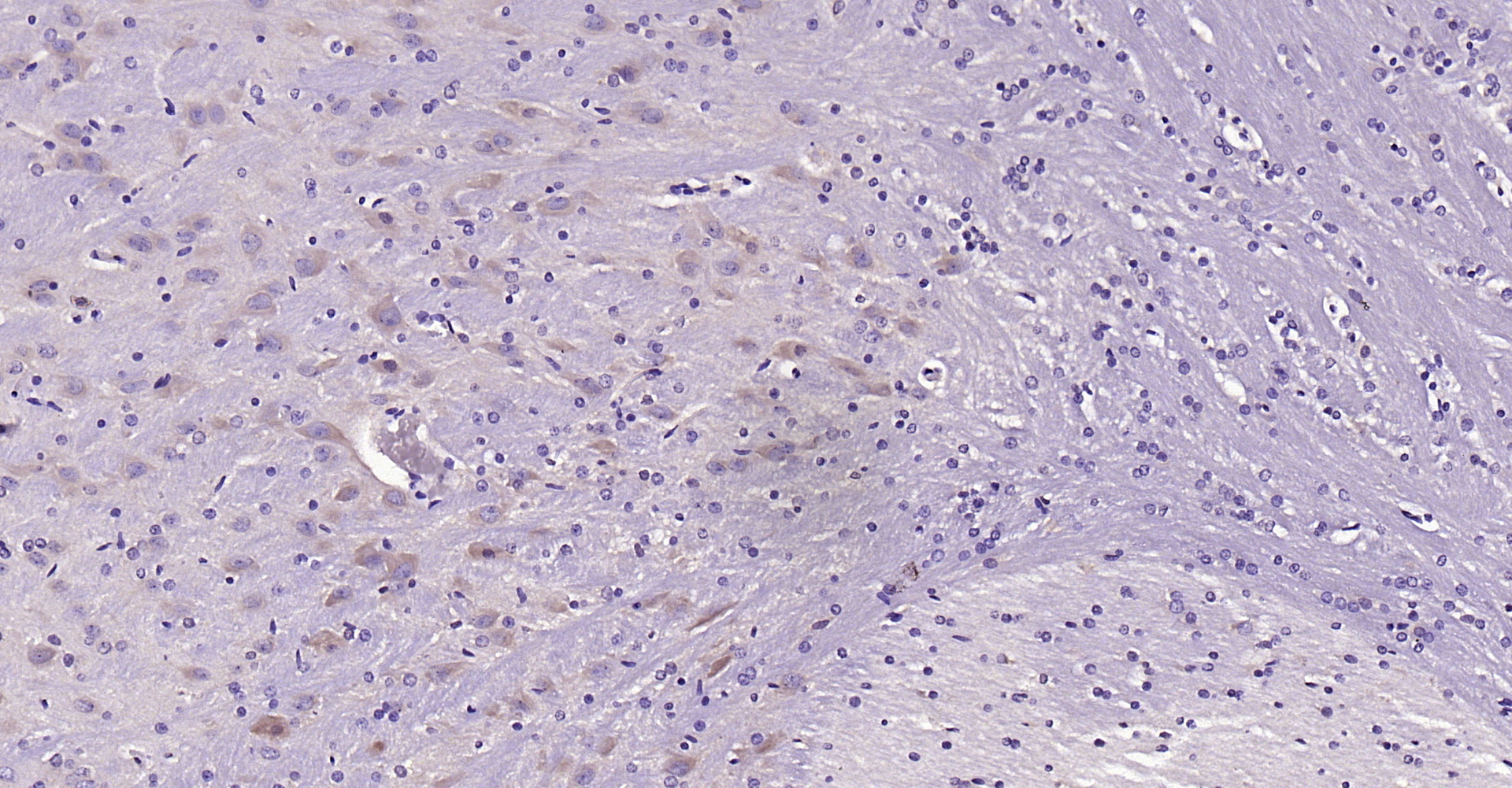 Paraformaldehyde-fixed, paraffin embedded Rat brain; Antigen retrieval by boiling in sodium citrate buffer (pH6.0) for 15min; Block endogenous peroxidase by 3% hydrogen peroxide for 20 minutes; Blocking buffer (normal goat serum) at 37°C for 30min; Antibody incubation with LIFR/CD118 Polyclonal Antibody, Unconjugated (bs-1458R) at 1:200 overnight at 4°C, DAB staining. Paraformaldehyde-fixed, paraffin embedded Rat brain; Antigen retrieval by boiling in sodium citrate buffer (pH6.0) for 15min; Block endogenous peroxidase by 3% hydrogen peroxide for 20 minutes; Blocking buffer (normal goat serum) at 37°C for 30min; Antibody incubation with LIFR/CD118 Polyclonal Antibody, Unconjugated (bs-1458R) at 1:200 overnight at 4°C, DAB staining.