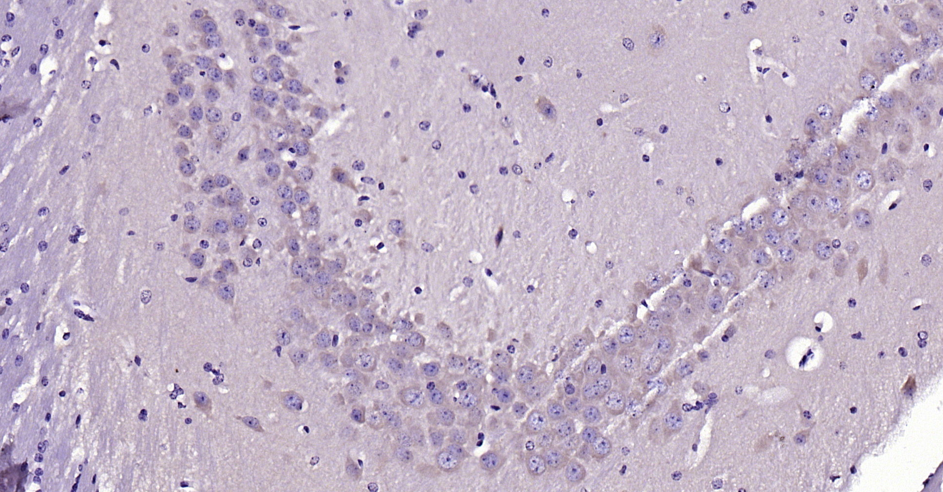 Paraformaldehyde-fixed, paraffin embedded Mouse brain; Antigen retrieval by boiling in sodium citrate buffer (pH6.0) for 15min; Block endogenous peroxidase by 3% hydrogen peroxide for 20 minutes; Blocking buffer (normal goat serum) at 37°C for 30min; Antibody incubation with LIFR/CD118 Polyclonal Antibody, Unconjugated (bs-1458R) at 1:200 overnight at 4°C, DAB staining. Paraformaldehyde-fixed, paraffin embedded Mouse brain; Antigen retrieval by boiling in sodium citrate buffer (pH6.0) for 15min; Block endogenous peroxidase by 3% hydrogen peroxide for 20 minutes; Blocking buffer (normal goat serum) at 37°C for 30min; Antibody incubation with LIFR/CD118 Polyclonal Antibody, Unconjugated (bs-1458R) at 1:200 overnight at 4°C, DAB staining.