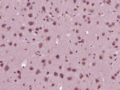 Paraformaldehyde-fixed, paraffin-embedded (mouse brain tissue); Antigen retrieval by boiling in sodium citrate buffer (pH6.0) for 15min; Block endogenous peroxidase by 3% hydrogen peroxide for 20 minutes; Blocking buffer (normal goat serum) at 37°C for 30min; Antibody incubation with (GOGA4) Polyclonal Antibody, Unconjugated (bs-13487R) at 1:400 overnight at 4°C, followed by DAB staining.