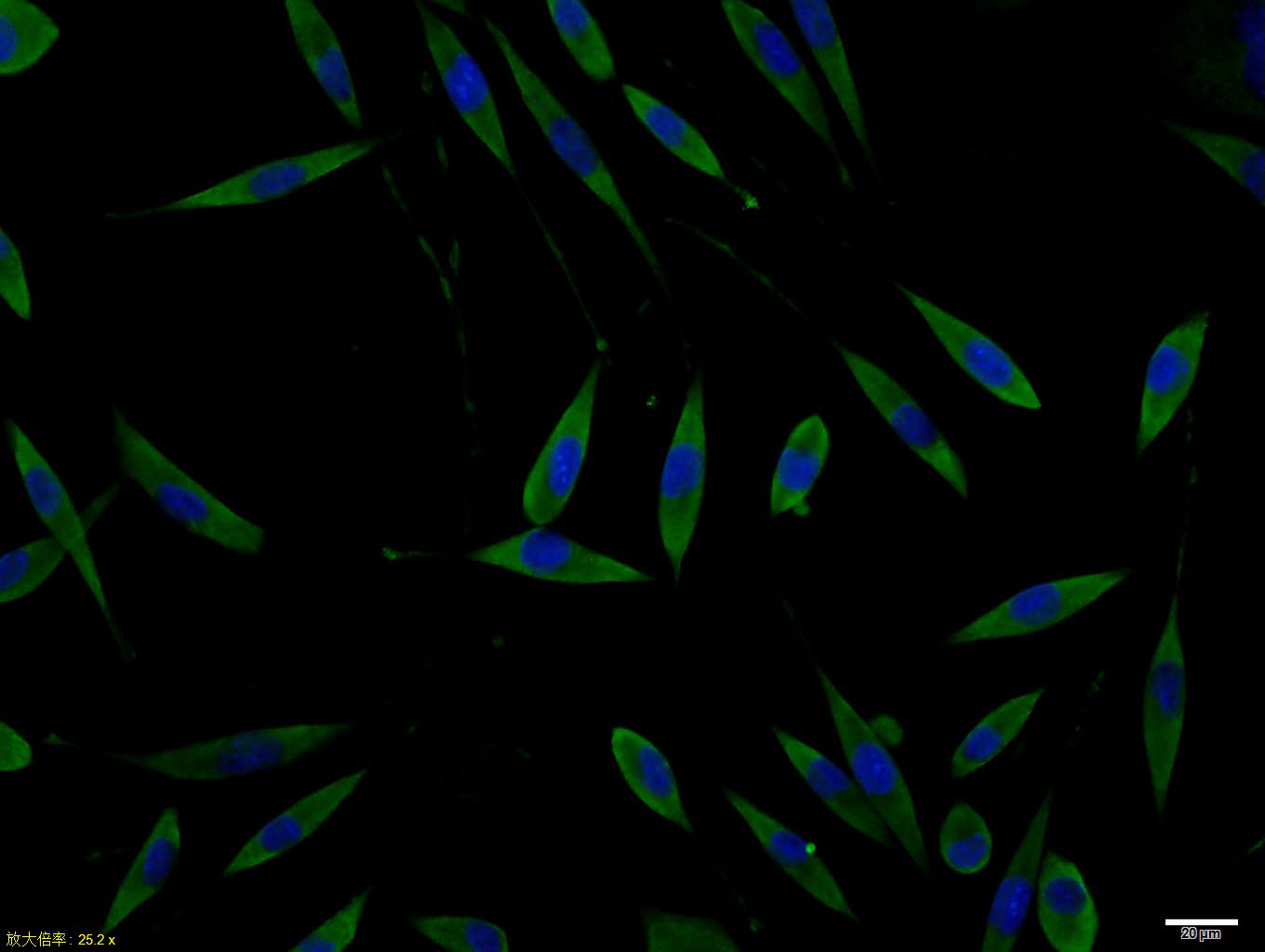 SHSY5Y cell; 4% Paraformaldehyde-fixed; Triton X-100 at room temperature for 20 min; Blocking buffer (normal goat serum, C-0005) at 37°C for 20 min; Antibody incubation with (Phospho-Doublecortin (Ser128)) polyclonal Antibody, Unconjugated (bs-3113R) 1:100, 90 minutes at 37°C; followed by a conjugated Goat Anti-Rabbit IgG antibody at 37°C for 90 minutes, DAPI (blue, C02-04002) was used to stain the cell nuclei.