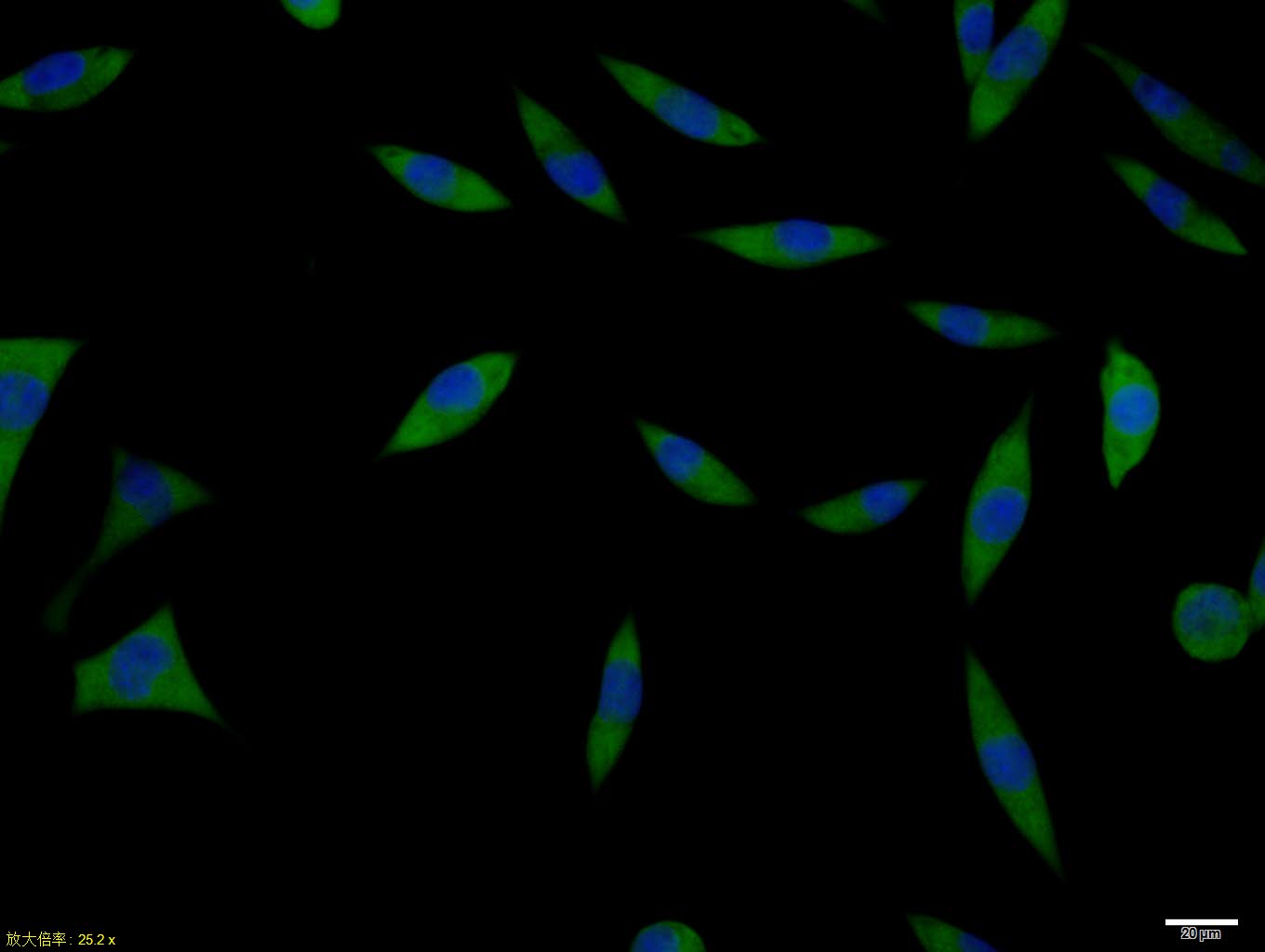 SHSY5Y cell; 4% Paraformaldehyde-fixed; Triton X-100 at room temperature for 20 min; Blocking buffer (normal goat serum, C-0005) at 37°C for 20 min; Antibody incubation with (ACE2) polyclonal Antibody, Unconjugated (bs-23028R) 1:100, 90 minutes at 37°C; followed by a conjugated Goat Anti-Rabbit IgG antibody at 37°C for 90 minutes, DAPI (blue, C02-04002) was used to stain the cell nuclei.