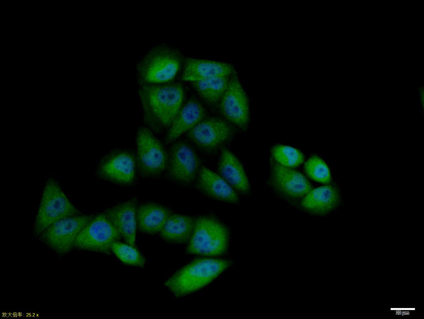 Hela cell; 4% Paraformaldehyde-fixed; Triton X-100 at room temperature for 20 min; Blocking buffer (normal goat serum, C-0005) at 37°C for 20 min; Antibody incubation with (Cyclin B1) polyclonal Antibody, Unconjugated (bs-0572R) 1:100, 90 minutes at 37°C; followed by a conjugated Goat Anti-Rabbit IgG antibody at 37°C for 90 minutes, DAPI (blue, C02-04002) was used to stain the cell nuclei.