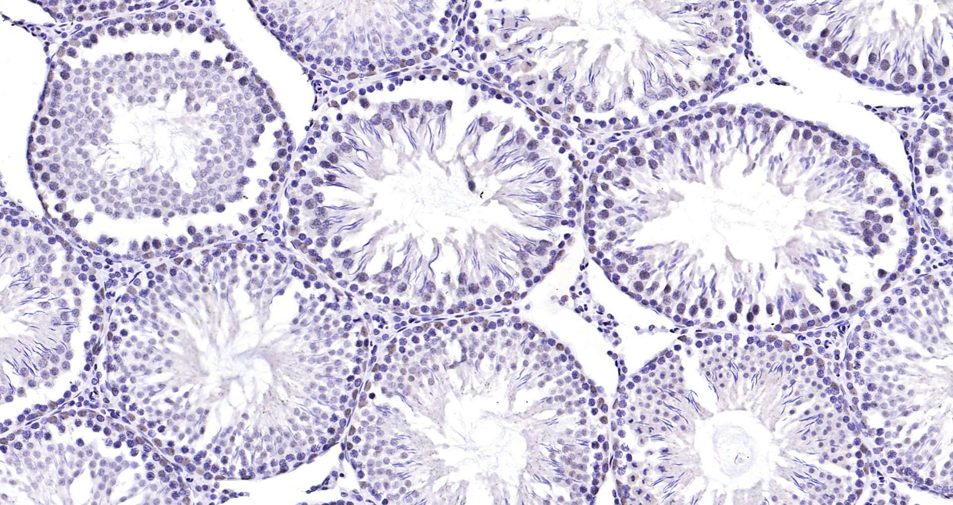 Paraformaldehyde-fixed, paraffin embedded Rat testis; Antigen retrieval by boiling in sodium citrate buffer (pH6.0) for 15min; Block endogenous peroxidase by 3% hydrogen peroxide for 20 minutes; Blocking buffer (normal goat serum) at 37°C for 30min; Antibody incubation with TSSK6 Polyclonal Antibody, Unconjugated (bs-9734R) at 1:200 overnight at 4°C, DAB staining.