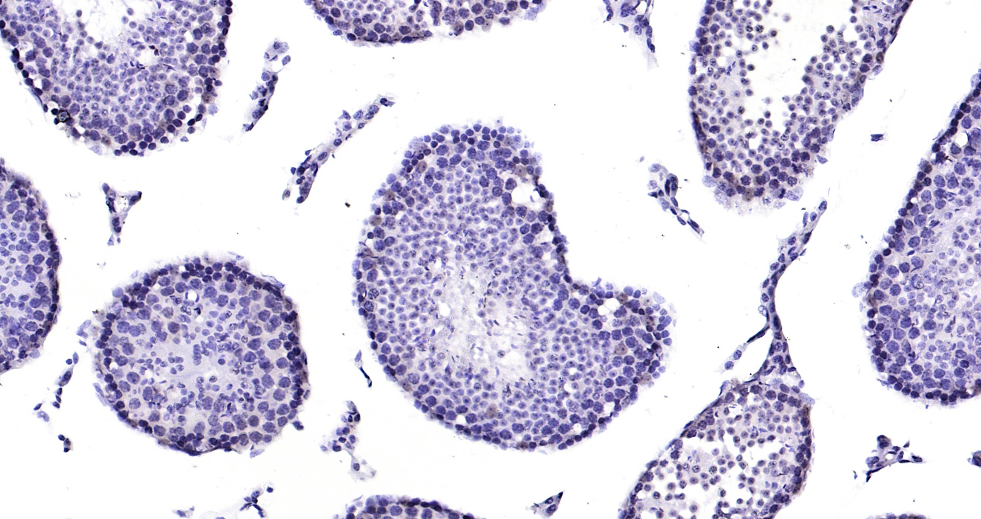 Paraformaldehyde-fixed, paraffin embedded Mouse testis; Antigen retrieval by boiling in sodium citrate buffer (pH6.0) for 15min; Block endogenous peroxidase by 3% hydrogen peroxide for 20 minutes; Blocking buffer (normal goat serum) at 37°C for 30min; Antibody incubation with TSSK6 Polyclonal Antibody, Unconjugated (bs-9734R) at 1:200 overnight at 4°C, DAB staining. Paraformaldehyde-fixed, paraffin embedded Mouse testis; Antigen retrieval by boiling in sodium citrate buffer (pH6.0) for 15min; Block endogenous peroxidase by 3% hydrogen peroxide for 20 minutes; Blocking buffer (normal goat serum) at 37°C for 30min; Antibody incubation with TSSK6 Polyclonal Antibody, Unconjugated (bs-9734R) at 1:200 overnight at 4°C, DAB staining.