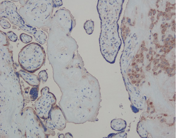 Formalin-fixed and paraffin-embedded human placenta labeled with CXCL1 Polyclonal Antibody, Unconjugated (bs-10234R) at 1:400. Image courtesy of Yi Zhang at Cedars-Sinai Medical Center.