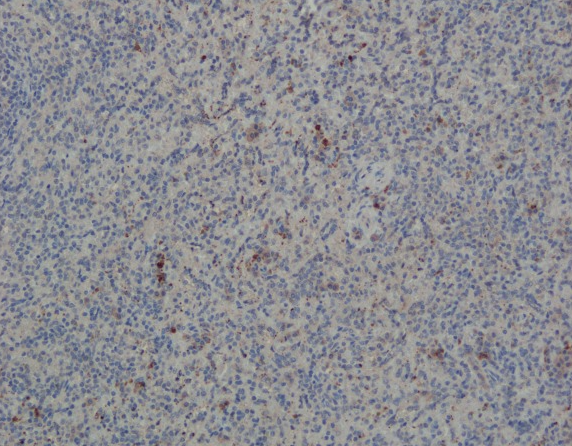 Formalin-fixed and paraffin embedded human spleen labeled with CXCL1 Polyclonal Antibody, Unconjugated (bs-10234R) at 1:400. Image courtesy of Yi Zhang at Cedars-Sinai Medical Center.