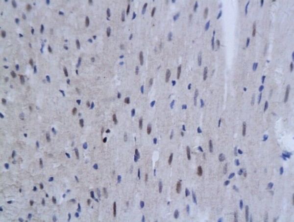 Formalin-fixed and paraffin embedded mouse myocardial tissue labeled with Anti SnoN Polyclonal Antibody, Unconjugated (bs-5945R) followed by conjugation to the secondary antibody and DAB staining