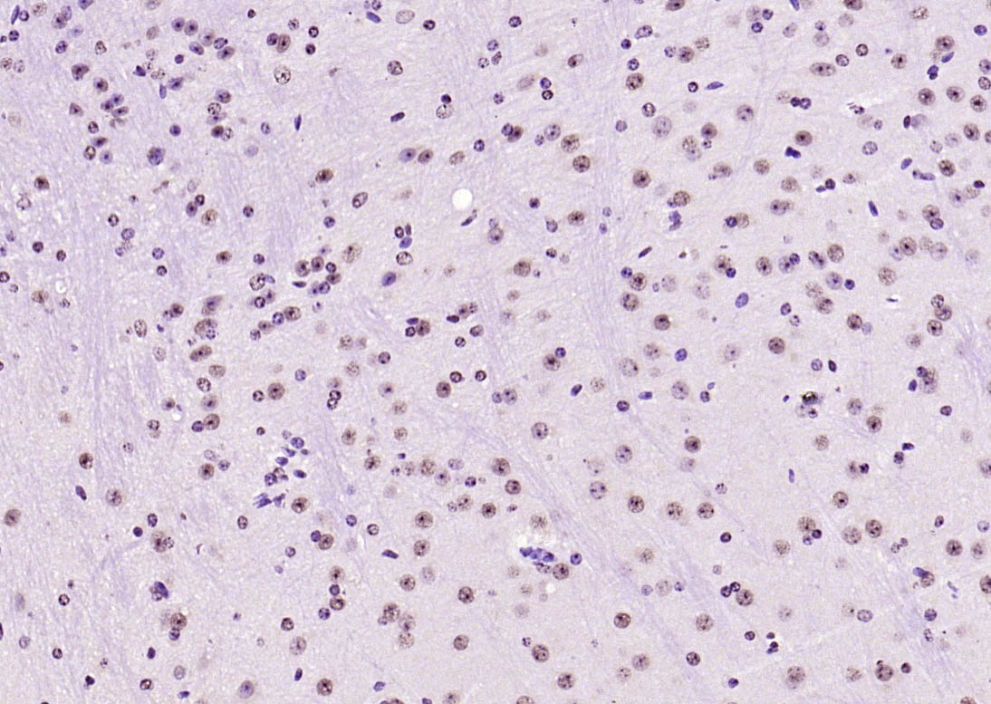 Paraformaldehyde-fixed, paraffin embedded (mouse brain); Antigen retrieval by boiling in sodium citrate buffer (pH6.0) for 15min; Block endogenous peroxidase by 3% hydrogen peroxide for 20 minutes; Blocking buffer (normal goat serum) at 37°C for 30min; Antibody incubation with (SOX9) Polyclonal Antibody, Unconjugated (bs-4177R) at 1:200 overnight at 4°C, followed by operating according to SP Kit(Rabbit) (sp-0023) instructionsand DAB staining.