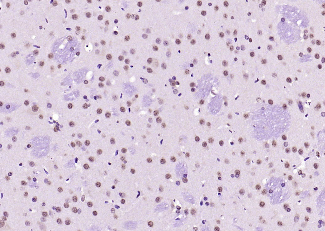 Paraformaldehyde-fixed, paraffin embedded (rat brain); Antigen retrieval by boiling in sodium citrate buffer (pH6.0) for 15min; Block endogenous peroxidase by 3% hydrogen peroxide for 20 minutes; Blocking buffer (normal goat serum) at 37°C for 30min; Antibody incubation with (SOX9) Polyclonal Antibody, Unconjugated (bs-4177R) at 1:200 overnight at 4°C, followed by operating according to SP Kit(Rabbit) (sp-0023) instructionsand DAB staining.