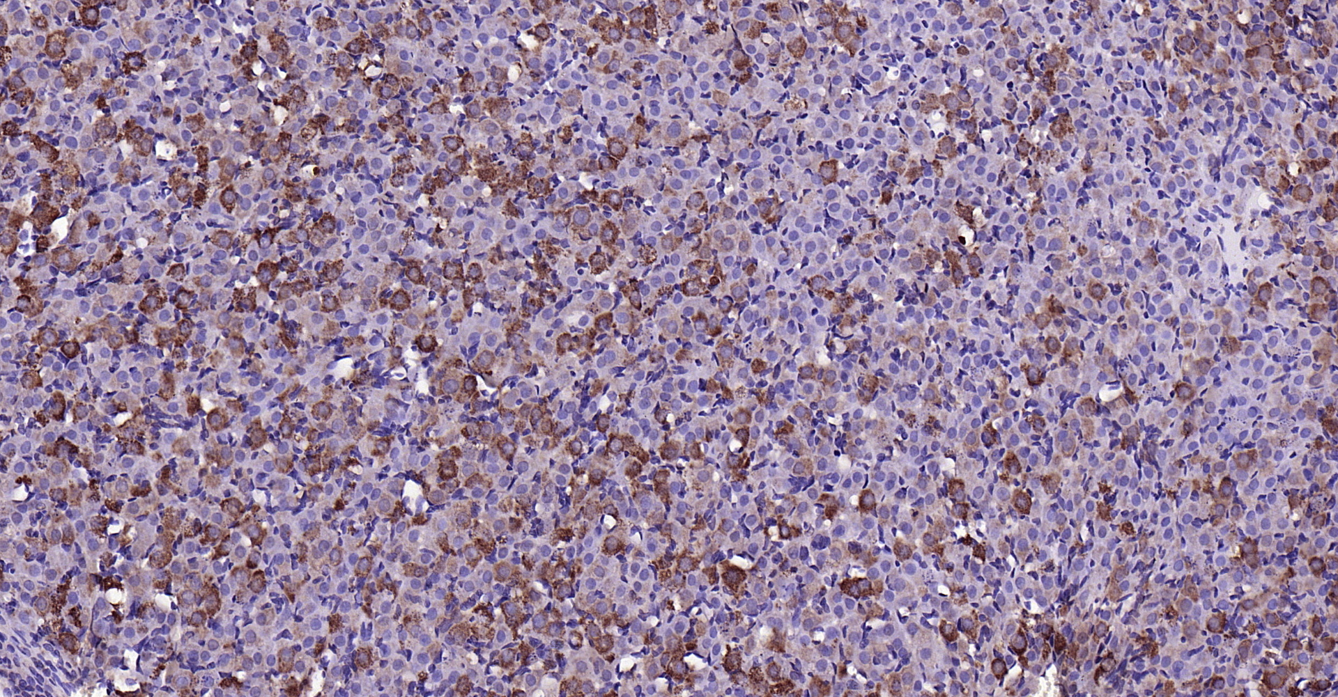 Paraformaldehyde-fixed, paraffin embedded (rat ovary); Antigen retrieval by boiling in sodium citrate buffer (pH6.0) for 15min; Block endogenous peroxidase by 3% hydrogen peroxide for 20 minutes; Blocking buffer (normal goat serum) at 37°C for 30min; Antibody incubation with (MMP-1) Polyclonal Antibody, Unconjugated (bs-4597R) at 1:200 overnight at 4°C, followed by operating according to SP Kit(Rabbit) (sp-0023) instructionsand DAB staining.