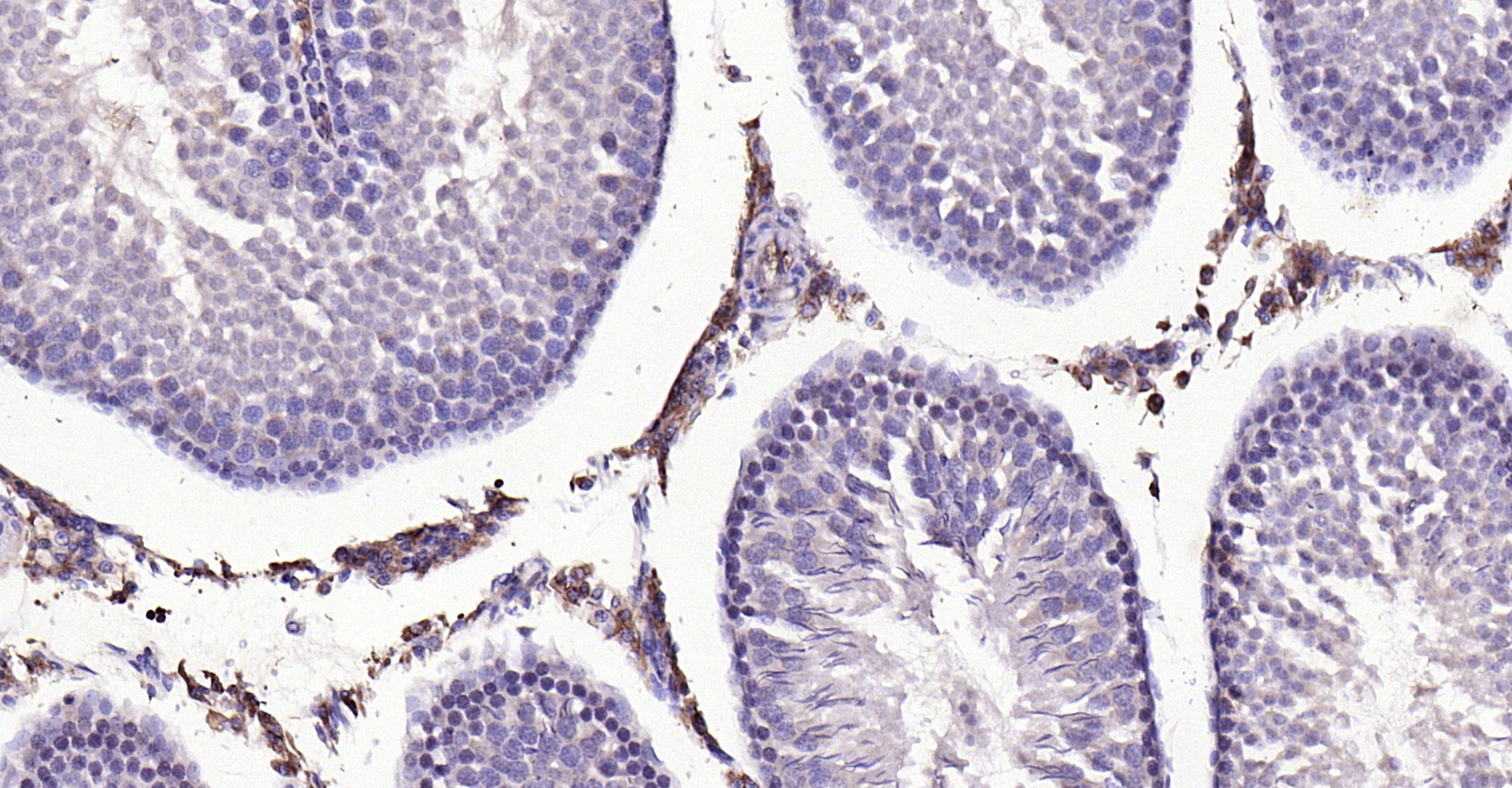 Paraformaldehyde-fixed, paraffin embedded (rat testis); Antigen retrieval by boiling in sodium citrate buffer (pH6.0) for 15min; Block endogenous peroxidase by 3% hydrogen peroxide for 20 minutes; Blocking buffer (normal goat serum) at 37°C for 30min; Antibody incubation with (MMP-1) Polyclonal Antibody, Unconjugated (bs-4597R) at 1:200 overnight at 4°C, followed by operating according to SP Kit(Rabbit) (sp-0023) instructionsand DAB staining.