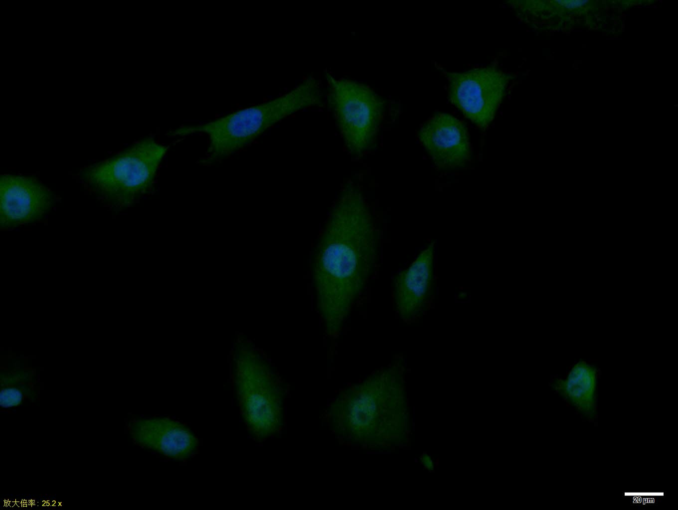 A549 cell; 4% Paraformaldehyde-fixed; Triton X-100 at room temperature for 20 min; Blocking buffer (normal goat serum, C-0005) at 37°C for 20 min; Antibody incubation with (phospho-IRS1 (Ser1101)) polyclonal Antibody, Unconjugated (bs-3197R) 1:100, 90 minutes at 37°C; followed by a conjugated Goat Anti-Rabbit IgG antibody at 37°C for 90 minutes, DAPI (blue, C02-04002) was used to stain the cell nuclei.