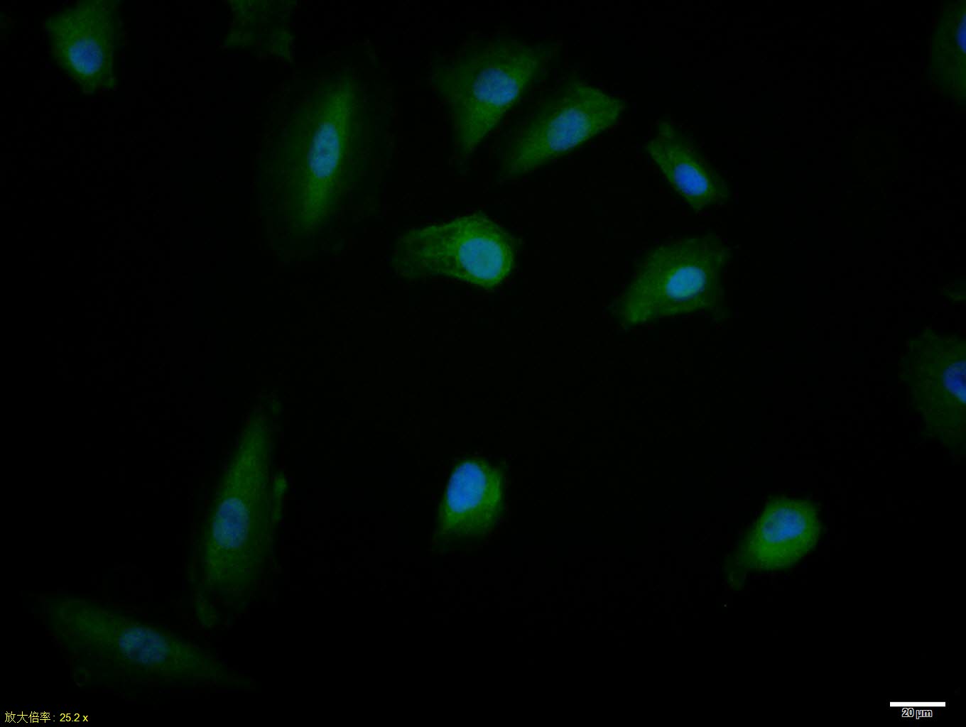 A549 cell; 4% Paraformaldehyde-fixed; Triton X-100 at room temperature for 20 min; Blocking buffer (normal goat serum, C-0005) at 37°C for 20 min; Antibody incubation with (phospho-IRS1 (Ser789)) polyclonal Antibody, Unconjugated (bs-3202R) 1:100, 90 minutes at 37°C; followed by a conjugated Goat Anti-Rabbit IgG antibody at 37°C for 90 minutes, DAPI (blue, C02-04002) was used to stain the cell nuclei. A549 cell; 4% Paraformaldehyde-fixed; Triton X-100 at room temperature for 20 min; Blocking buffer (normal goat serum, C-0005) at 37°C for 20 min; Antibody incubation with (phospho-IRS1 (Ser789)) polyclonal Antibody, Unconjugated (bs-3202R) 1:100, 90 minutes at 37°C; followed by a conjugated Goat Anti-Rabbit IgG antibody at 37°C for 90 minutes, DAPI (blue, C02-04002) was used to stain the cell nuclei.