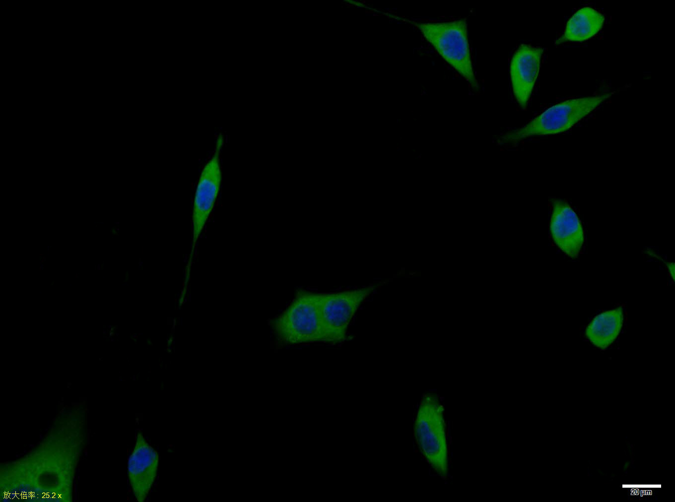 SHSY5Y cell; 4% Paraformaldehyde-fixed; Triton X-100 at room temperature for 20 min; Blocking buffer (normal goat serum, C-0005) at 37°C for 20 min; Antibody incubation with (Netrin 1) polyclonal Antibody, Unconjugated (bs-1858R) 1:100, 90 minutes at 37°C; followed by a conjugated Goat Anti-Rabbit IgG antibody at 37°C for 90 minutes, DAPI (blue, C02-04002) was used to stain the cell nuclei.