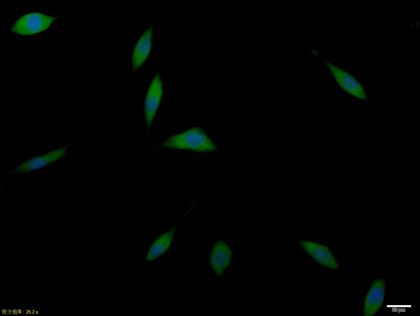 SHSY5Y cell; 4% Paraformaldehyde-fixed; Triton X-100 at room temperature for 20 min; Blocking buffer (normal goat serum, C-0005) at 37°C for 20 min; Antibody incubation with (GLUT12 ) polyclonal Antibody, Unconjugated (bs-2540R) 1:100, 90 minutes at 37°C; followed by a conjugated Goat Anti-Rabbit IgG antibody at 37°C for 90 minutes, DAPI (blue, C02-04002) was used to stain the cell nuclei. SHSY5Y cell; 4% Paraformaldehyde-fixed; Triton X-100 at room temperature for 20 min; Blocking buffer (normal goat serum, C-0005) at 37°C for 20 min; Antibody incubation with (GLUT12 ) polyclonal Antibody, Unconjugated (bs-2540R) 1:100, 90 minutes at 37°C; followed by a conjugated Goat Anti-Rabbit IgG antibody at 37°C for 90 minutes, DAPI (blue, C02-04002) was used to stain the cell nuclei.