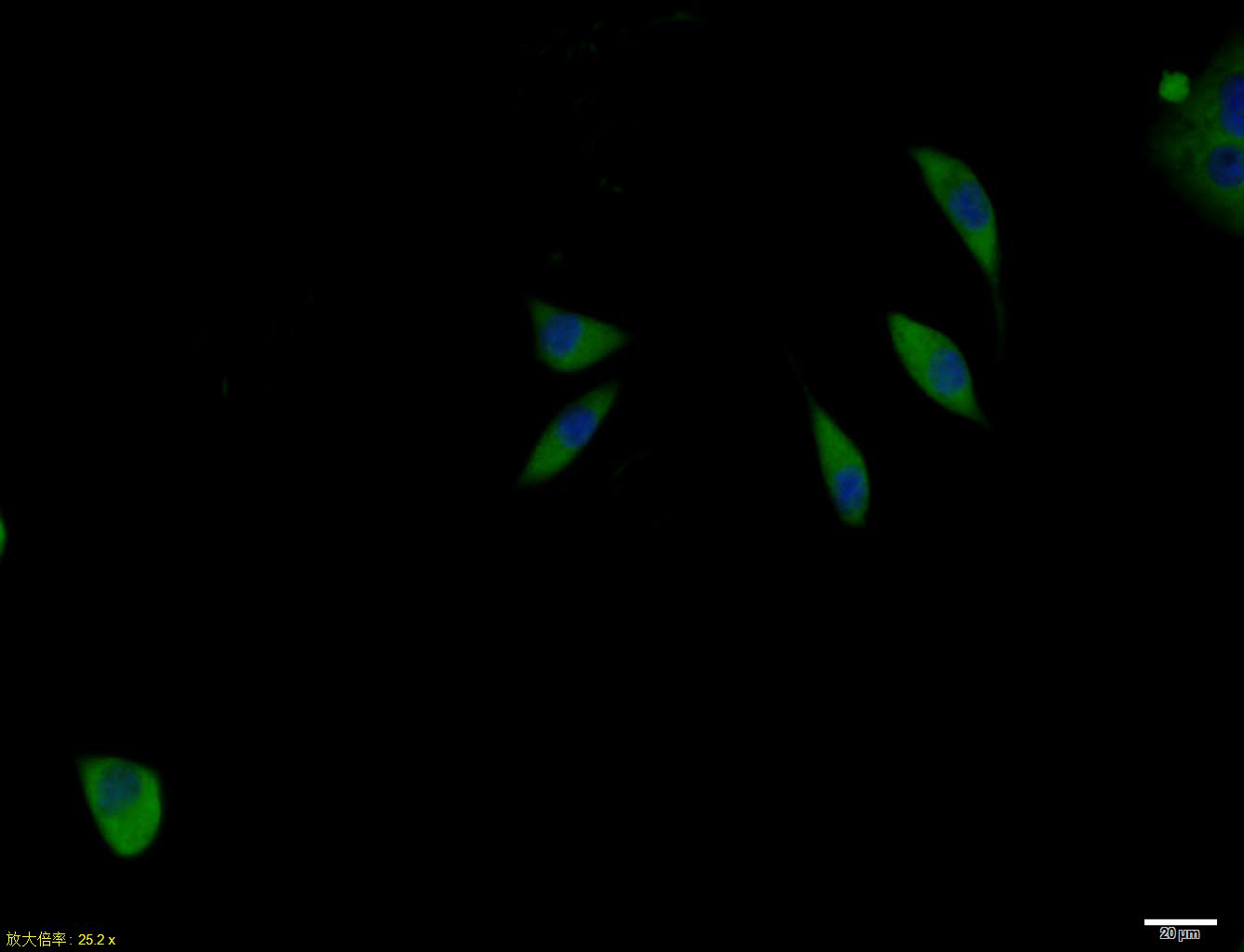 SHSY5Y cell; 4% Paraformaldehyde-fixed; Triton X-100 at room temperature for 20 min; Blocking buffer (normal goat serum, C-0005) at 37°C for 20 min; Antibody incubation with (IL-2R gamma) polyclonal Antibody, Unconjugated (bs-2545R) 1:100, 90 minutes at 37°C; followed by a conjugated Goat Anti-Rabbit IgG antibody at 37°C for 90 minutes, DAPI (blue, C02-04002) was used to stain the cell nuclei.