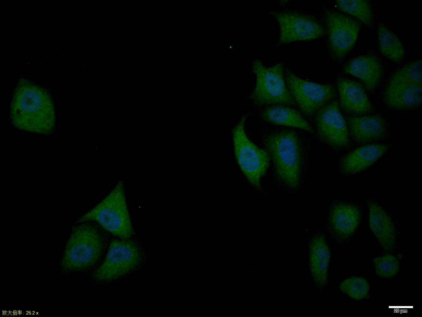 Hela cell; 4% Paraformaldehyde-fixed; Triton X-100 at room temperature for 20 min; Blocking buffer (normal goat serum, C-0005) at 37°C for 20 min; Antibody incubation with (BCL2L1) polyclonal Antibody, Unconjugated (bs-1336R) 1:100, 90 minutes at 37°C; followed by a conjugated Goat Anti-Rabbit IgG antibody at 37°C for 90 minutes, DAPI (blue, C02-04002) was used to stain the cell nuclei.