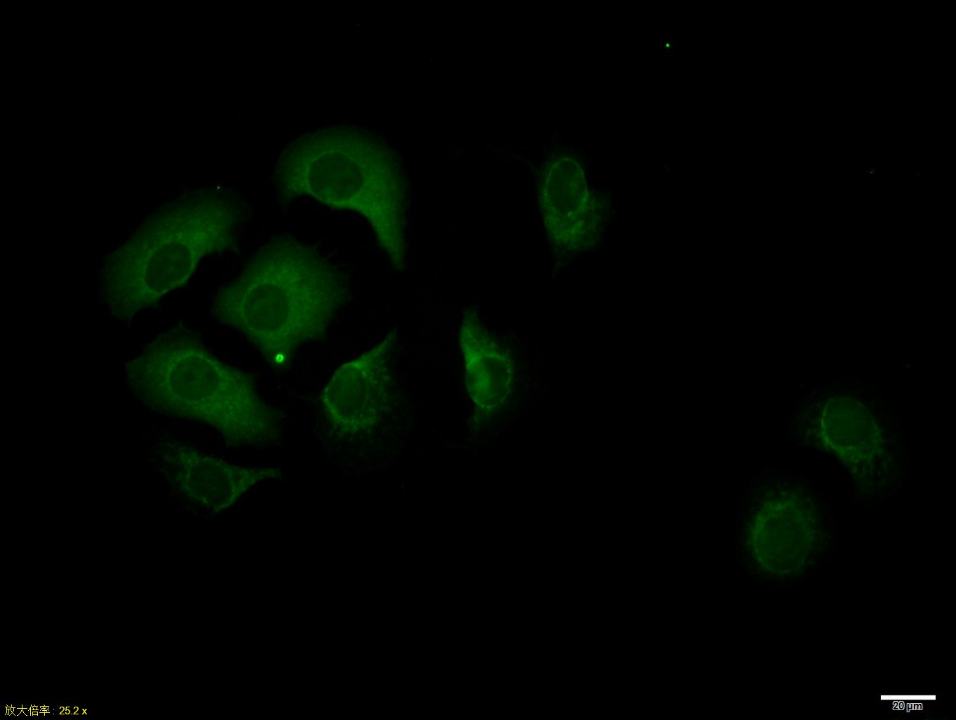 HepG2 cell; 4% Paraformaldehyde-fixed; Triton X-100 at room temperature for 20 min; Blocking buffer (normal goat serum, C-0005) at 37°C for 20 min; Antibody incubation with (TTR/Prealbumin) polyclonal Antibody, Unconjugated (bs-0152R) 1:100, 90 minutes at 37°C; followed by a conjugated Goat Anti-Rabbit IgG antibody at 37°C for 90 minutes, DAPI (blue, C02-04002) was used to stain the cell nuclei.