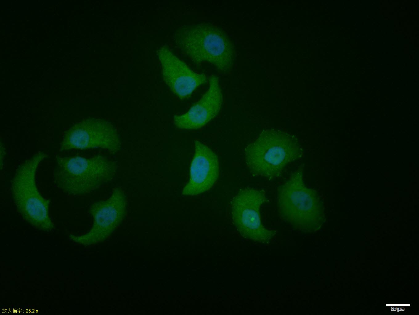 HepG2 cell; 4% Paraformaldehyde-fixed; Triton X-100 at room temperature for 20 min; Blocking buffer (normal goat serum, C-0005) at 37°C for 20 min; Antibody incubation with (XBP1) polyclonal Antibody, Unconjugated (bs-1668R) 1:100, 90 minutes at 37°C; followed by a conjugated Goat Anti-Rabbit IgG antibody at 37°C for 90 minutes, DAPI (blue, C02-04002) was used to stain the cell nuclei.