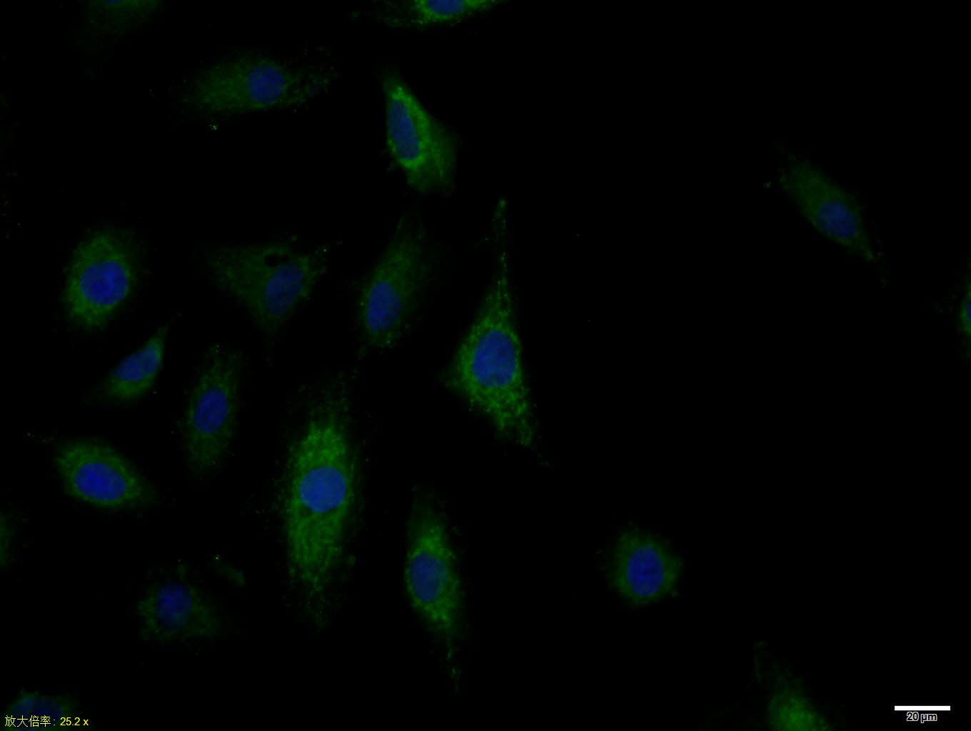 A549 cell; 4% Paraformaldehyde-fixed; Triton X-100 at room temperature for 20 min; Blocking buffer (normal goat serum, C-0005) at 37°C for 20 min; Antibody incubation with (TLR9) polyclonal Antibody, Unconjugated (bs-2717R) 1:100, 90 minutes at 37°C; followed by a conjugated Goat Anti-Rabbit IgG antibody at 37°C for 90 minutes, DAPI (blue, C02-04002) was used to stain the cell nuclei.
