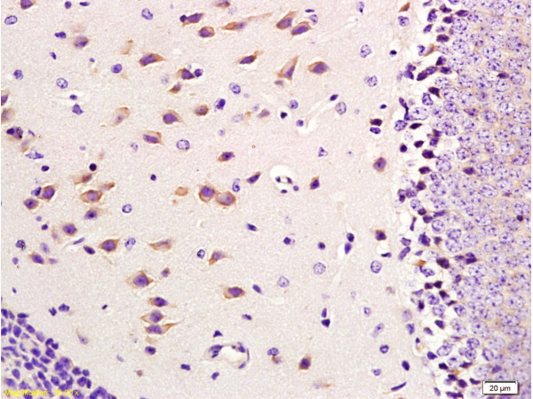 Formalin-fixed and paraffin embedded mouse brain tissue labeled with Anti-CD11b/Integrin αM/Integrin Alpha M Polyclonal Antibody, Unconjugated (bs-1014R) at 1:300, followed by conjugation to the secondary antibody and DAB staining