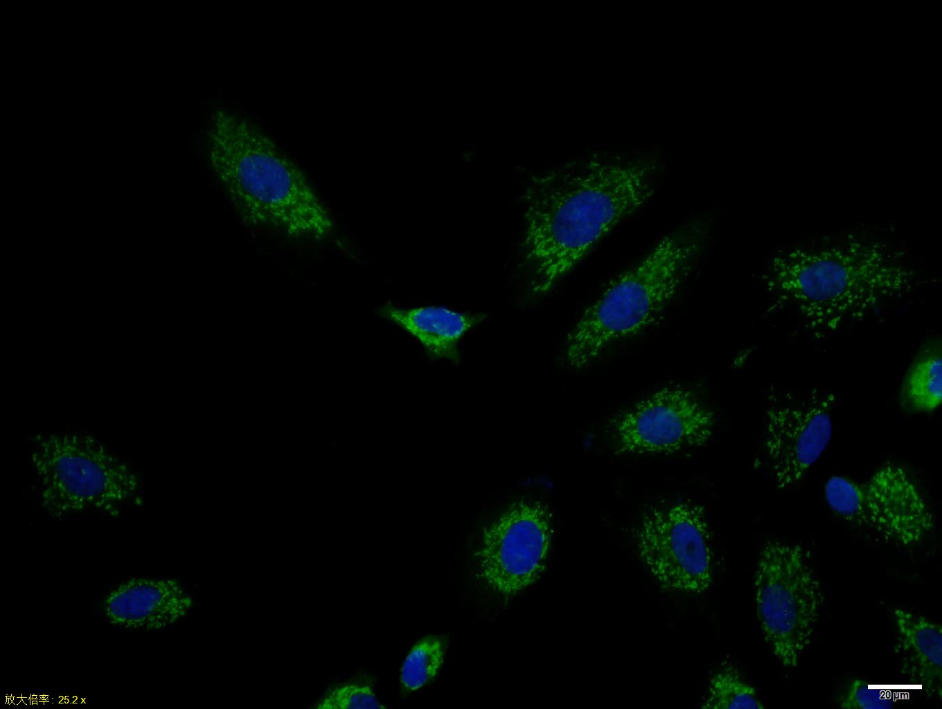 A549 cell; 4% Paraformaldehyde-fixed; Triton X-100 at room temperature for 20 min; Blocking buffer (normal goat serum, C-0005) at 37°C for 20 min; Antibody incubation with (Cytokeratin 7) polyclonal Antibody, Unconjugated (bs-1744R) 1:100, 90 minutes at 37°C; followed by a conjugated Goat Anti-Rabbit IgG antibody at 37°C for 90 minutes, DAPI (blue, C02-04002) was used to stain the cell nuclei.