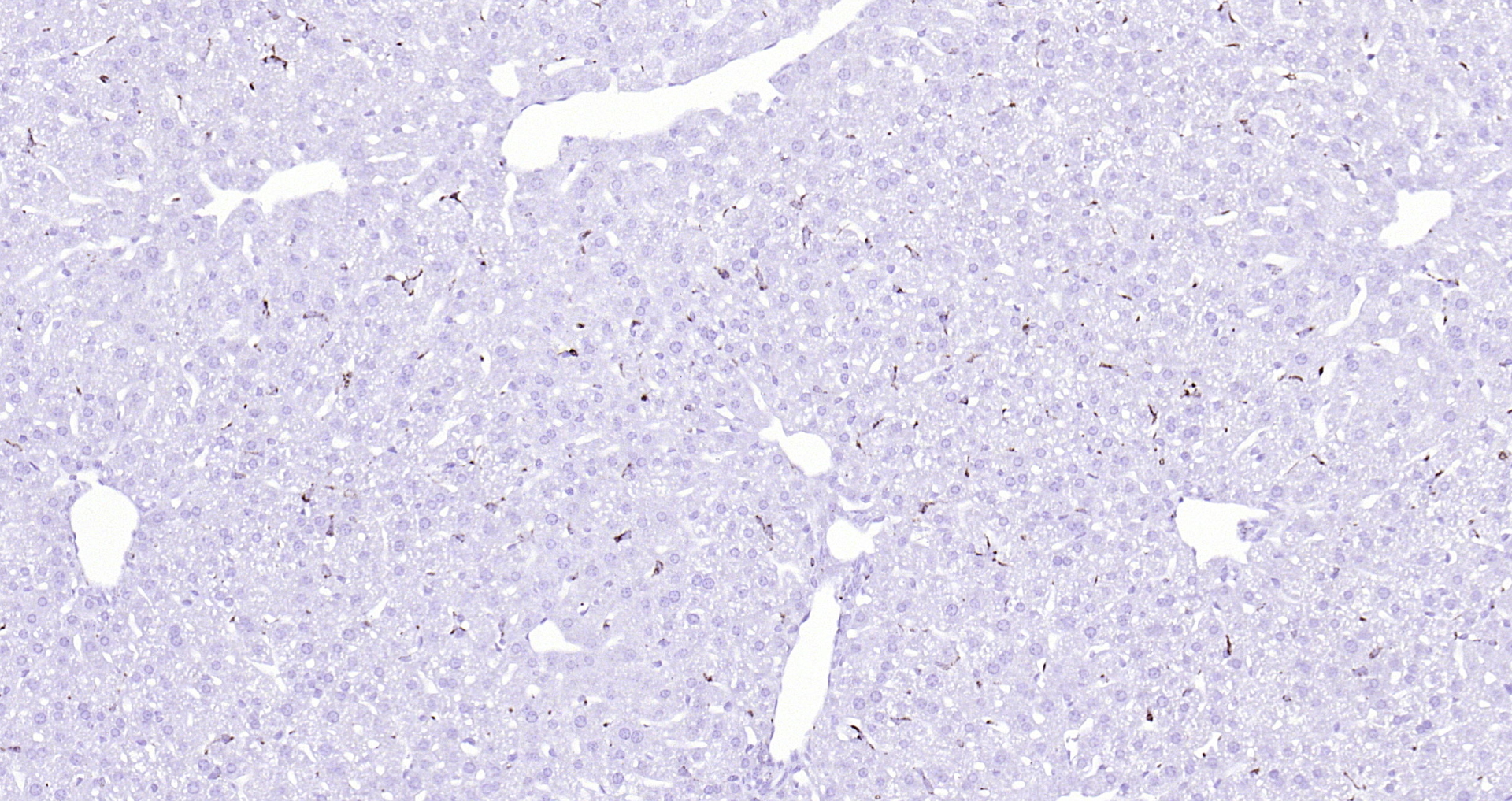 Paraformaldehyde-fixed, paraffin embedded (mouse liver); Antigen retrieval by boiling in sodium citrate buffer (pH6.0) for 15min; Block endogenous peroxidase by 3% hydrogen peroxide for 20 minutes; Blocking buffer (normal goat serum) at 37°C for 30min; Antibody incubation with (CD68) Polyclonal Antibody, Unconjugated (bs-0649R) at 1:200 overnight at 4°C, followed by operating according to SP Kit(Rabbit) (sp-0023) instructionsand DAB staining.