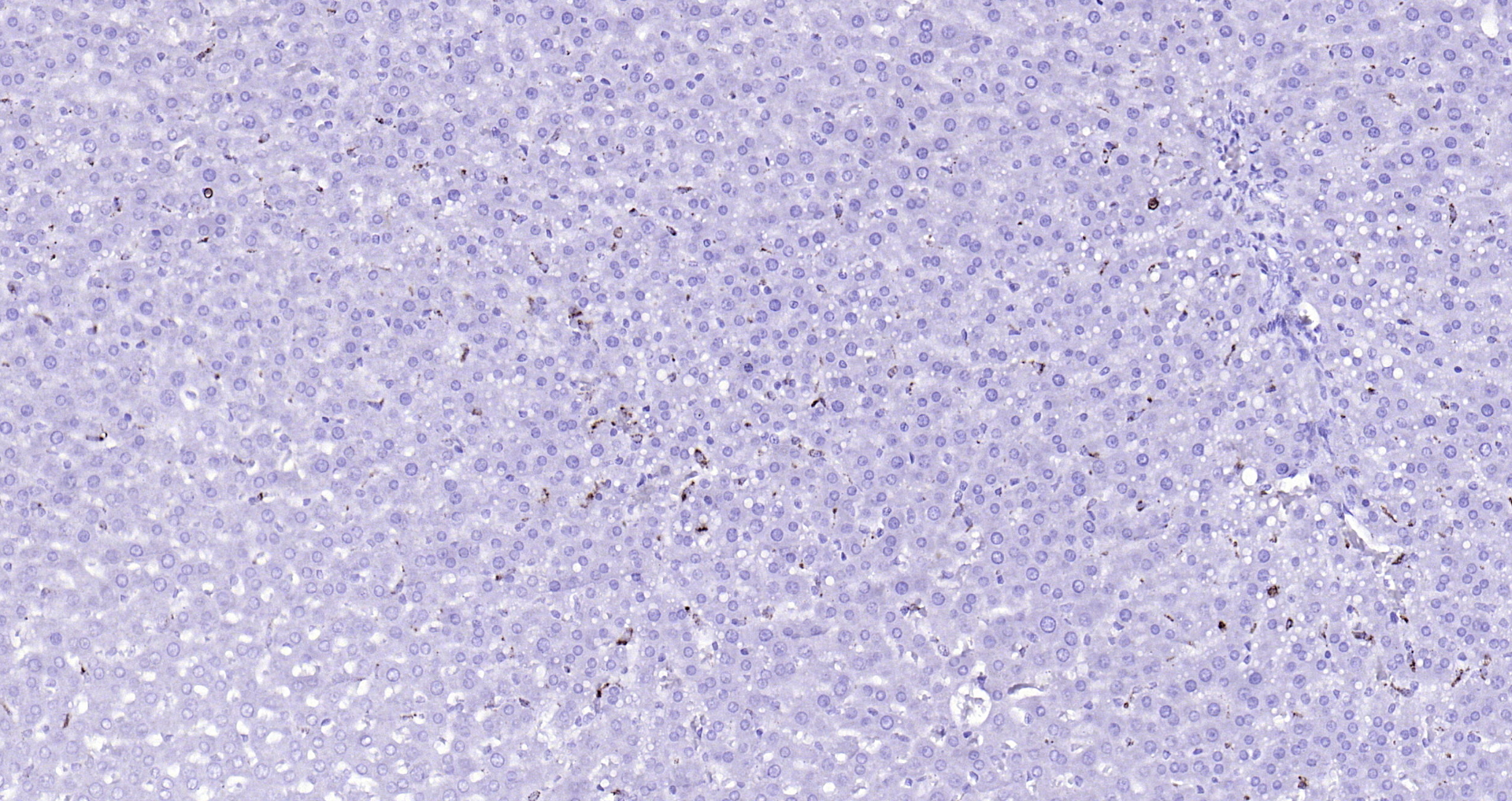 Paraformaldehyde-fixed, paraffin embedded (rat liver); Antigen retrieval by boiling in sodium citrate buffer (pH6.0) for 15min; Block endogenous peroxidase by 3% hydrogen peroxide for 20 minutes; Blocking buffer (normal goat serum) at 37°C for 30min; Antibody incubation with (CD68) Polyclonal Antibody, Unconjugated (bs-0649R) at 1:200 overnight at 4°C, followed by operating according to SP Kit(Rabbit) (sp-0023) instructionsand DAB staining.