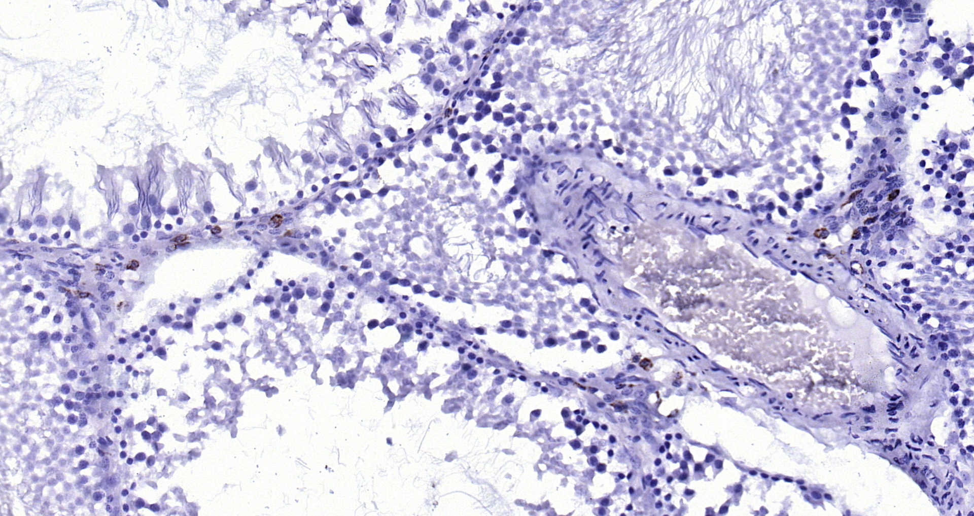 Paraformaldehyde-fixed, paraffin embedded (rat testis); Antigen retrieval by boiling in sodium citrate buffer (pH6.0) for 15min; Block endogenous peroxidase by 3% hydrogen peroxide for 20 minutes; Blocking buffer (normal goat serum) at 37°C for 30min; Antibody incubation with (CD68) Polyclonal Antibody, Unconjugated (bs-0649R) at 1:200 overnight at 4°C, followed by operating according to SP Kit(Rabbit) (sp-0023) instructionsand DAB staining.