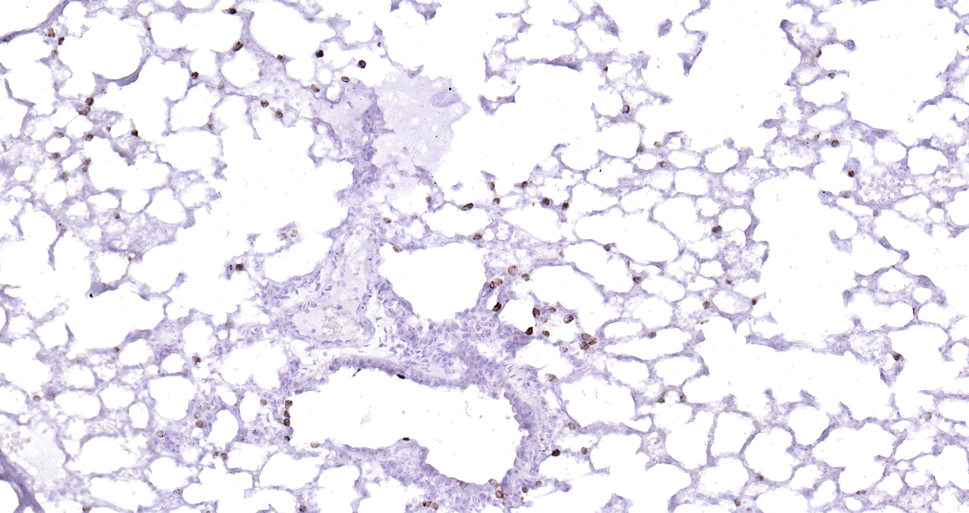 Paraformaldehyde-fixed, paraffin embedded (mouse lung); Antigen retrieval by boiling in sodium citrate buffer (pH6.0) for 15min; Block endogenous peroxidase by 3% hydrogen peroxide for 20 minutes; Blocking buffer (normal goat serum) at 37°C for 30min; Antibody incubation with (CD68) Polyclonal Antibody, Unconjugated (bs-0649R) at 1:200 overnight at 4°C, followed by operating according to SP Kit(Rabbit) (sp-0023) instructionsand DAB staining.