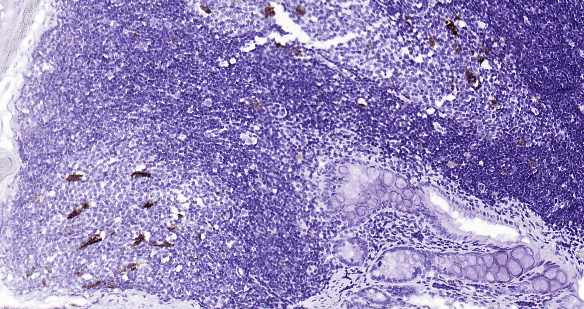 Paraformaldehyde-fixed, paraffin embedded (mouse colon); Antigen retrieval by boiling in sodium citrate buffer (pH6.0) for 15min; Block endogenous peroxidase by 3% hydrogen peroxide for 20 minutes; Blocking buffer (normal goat serum) at 37°C for 30min; Antibody incubation with (CD68) Polyclonal Antibody, Unconjugated (bs-0649R) at 1:200 overnight at 4°C, followed by operating according to SP Kit(Rabbit) (sp-0023) instructionsand DAB staining.