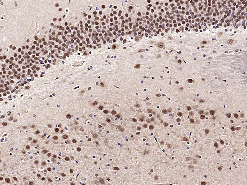 Paraformaldehyde-fixed, paraffin embedded Rat brain; Antigen retrieval by boiling in sodium citrate buffer (pH6.0) for 15min; Block endogenous peroxidase by 3% hydrogen peroxide for 20 minutes; Blocking buffer (normal goat serum) at 37°C for 30min; Antibody incubation with PHAP1 Polyclonal Antibody, Unconjugated (bs-6083R) at 1:400 overnight at 4°C, DAB staining.
