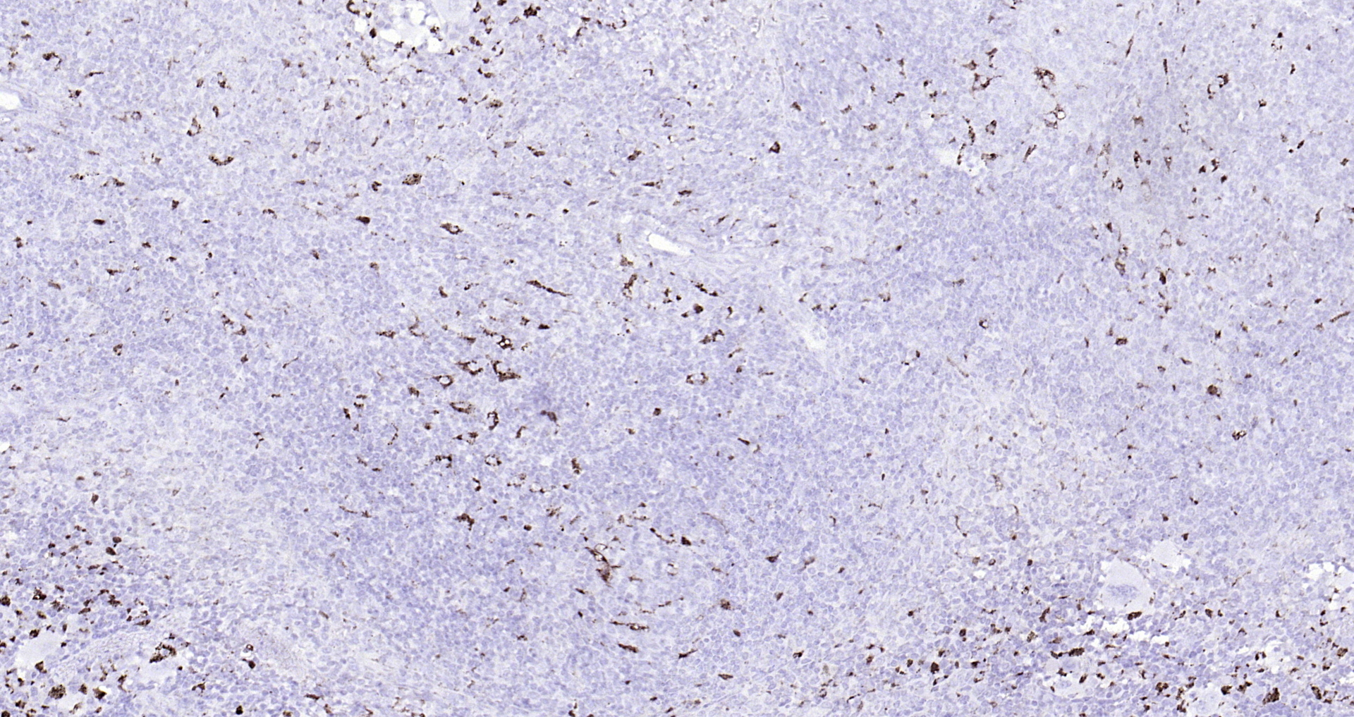 Paraformaldehyde-fixed, paraffin embedded (mouse spleen); Antigen retrieval by boiling in sodium citrate buffer (pH6.0) for 15min; Block endogenous peroxidase by 3% hydrogen peroxide for 20 minutes; Blocking buffer (normal goat serum) at 37°C for 30min; Antibody incubation with (CD68) Polyclonal Antibody, Unconjugated (bs-0649R) at 1:200 overnight at 4°C, followed by operating according to SP Kit(Rabbit) (sp-0023) instructionsand DAB staining.