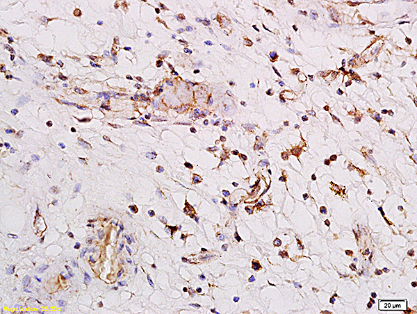 Formalin-fixed and paraffin embedded human enterocolitis labeled with Anti PARG1/Rho GTPase activating protein 29 Polyclonal Antibody, Unconjugated (bs-6098R) followed by conjugation to the secondary antibody and DAB staining
