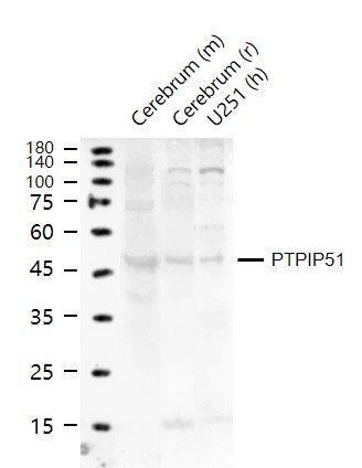 Lane 1: Mouse Cerebrum tissue lysates; Lane 2: Rat Cerebrum tissue lysates; Lane 3: Human U251 cell lysates probed with PTPIP51 Polyclonal Antibody, Unconjugated (bs-5719R) at 1:1000 dilution and 4°C overnight incubation. Followed by conjugated secondary antibody incubation at 1:20000 for 60 min at 37˚C.