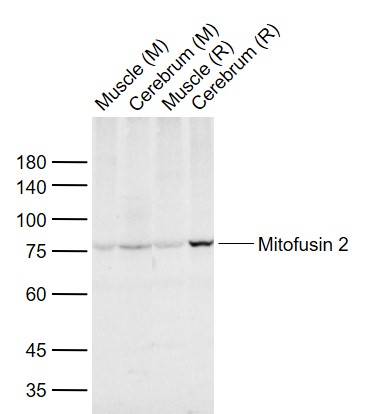 Lane 1: Mouse Muscle tissue lysates; Lane 2: Mouse Cerebrum tissue lysates; Lane 3: Rat Muscle tissue lysates; Lane 4: Rat Cerebrum tissue lysates probed with Mitofusin 2 Polyclonal Antibody, Unconjugated (bs-2988R) at 1:1000 dilution and 4°C overnight incubation. Followed by conjugated secondary antibody incubation at 1:20000 for 60 min at 37˚C.