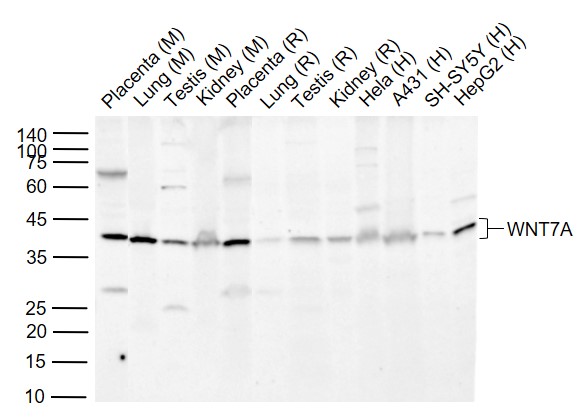 Lane 1: Mouse Placenta tissue lysates; Lane 2: Mouse Lung tissue lysates; Lane 3: Mouse Testis tissue lysates; Lane 4: Mouse Kidney tissue lysates ; Lane 5: Rat Placenta tissue lysates; Lane 6: Rat Lung tissue lysates; Lane 7: Rat Testis tissue lysates ; Lane 8: Rat Kidney tissue lysates ; Lane 9: Human Hela cell lysates ; Lane 10: Human A431 cell lysates ; Lane 11: Human SH-SY5Y cell lysates ; Lane 12: Human HepG2 cell lysates probed with WNT7A Polyclonal Antibody, Unconjugated (bs-6645R) at 1:1000 dilution and 4°C overnight incubation. Followed by conjugated secondary antibody incubation at 1:20000 for 60 min at 37˚C.