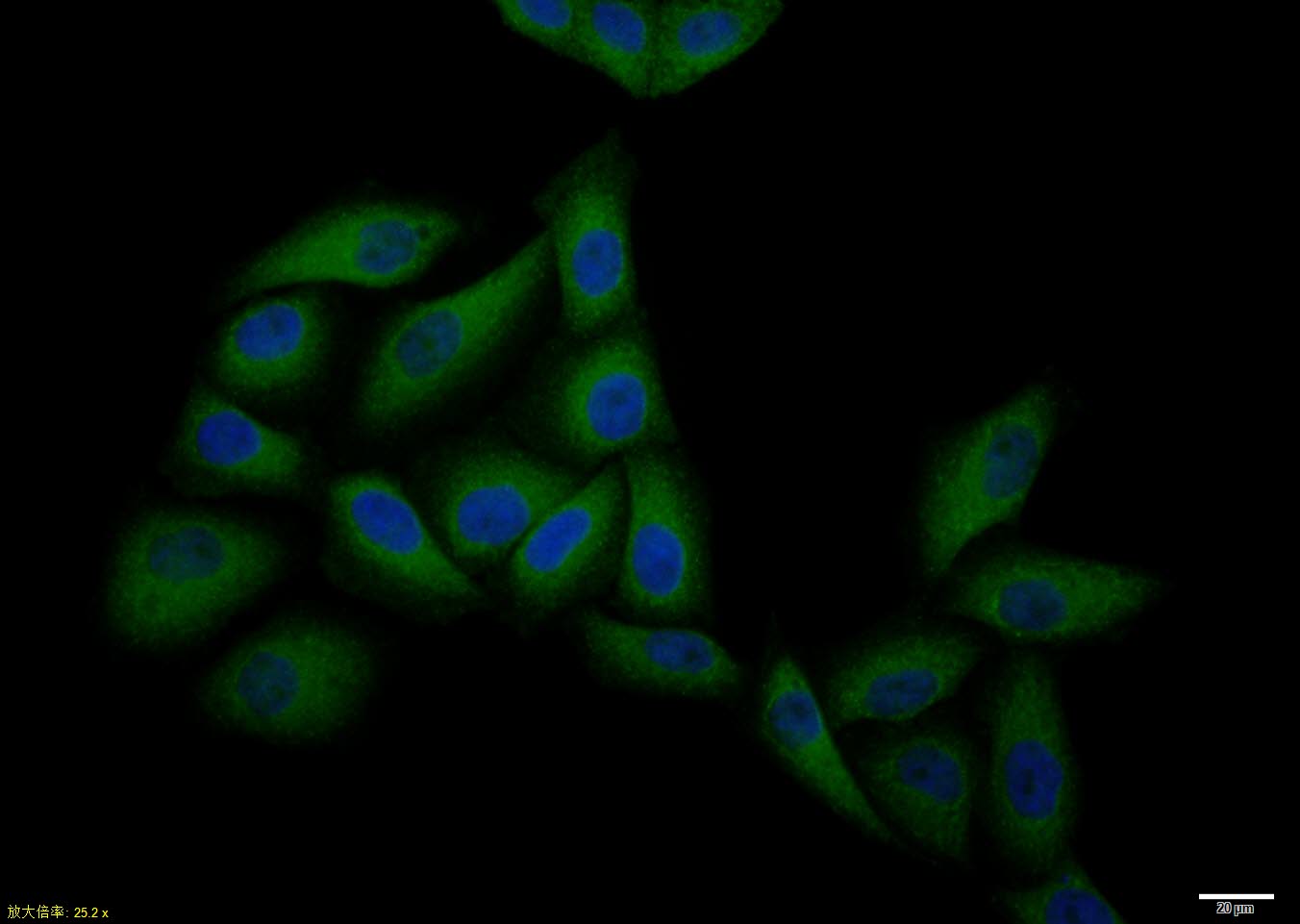 Hela cell; 4% Paraformaldehyde-fixed; Triton X-100 at room temperature for 20 min; Blocking buffer (normal goat serum, C-0005) at 37°C for 20 min; Antibody incubation with (CCR7) polyclonal Antibody, Unconjugated (bs-1305R) 1:100, 90 minutes at 37°C; followed by a conjugated Goat Anti-Rabbit IgG antibody at 37°C for 90 minutes, DAPI (blue, C02-04002) was used to stain the cell nuclei.
