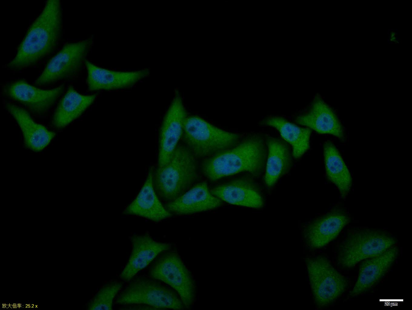 Hela cell; 4% Paraformaldehyde-fixed; Triton X-100 at room temperature for 20 min; Blocking buffer (normal goat serum, C-0005) at 37°C for 20 min; Antibody incubation with (ATF4) polyclonal Antibody, Unconjugated (bs-1531R) 1:100, 90 minutes at 37°C; followed by a conjugated Goat Anti-Rabbit IgG antibody at 37°C for 90 minutes, DAPI (blue, C02-04002) was used to stain the cell nuclei.
