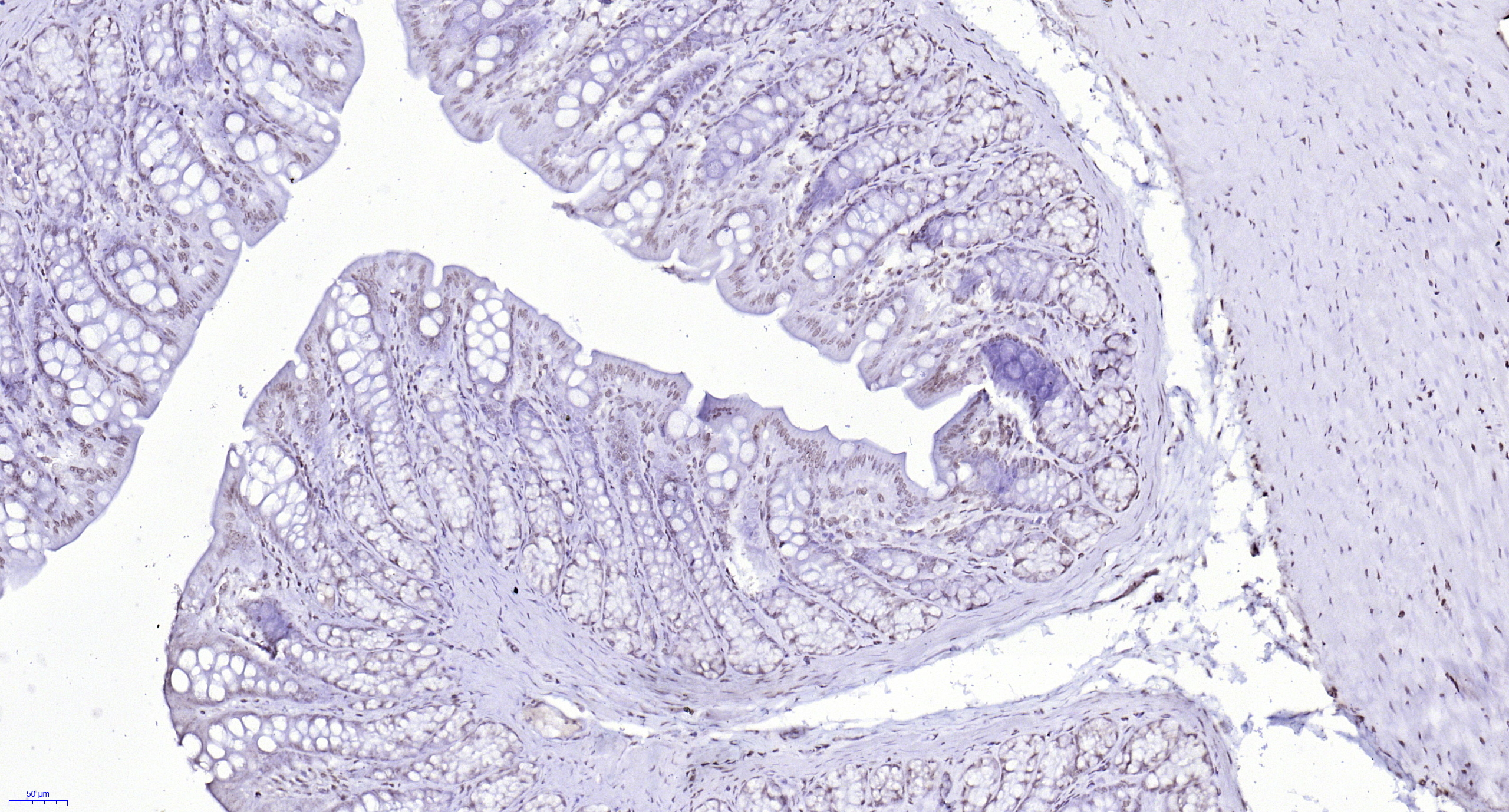 Paraformaldehyde-fixed, paraffin embedded (rat colon); Antigen retrieval by boiling in sodium citrate buffer (pH6.0) for 15min; Block endogenous peroxidase by 3% hydrogen peroxide for 20 minutes; Blocking buffer (normal goat serum) at 37°C for 30min; Antibody incubation with (RNF113A) Polyclonal Antibody, Unconjugated (bs-9248R) at 1:200 overnight at 4°C, followed by operating according to SP Kit(Rabbit) (sp-0023) instructionsand DAB staining.