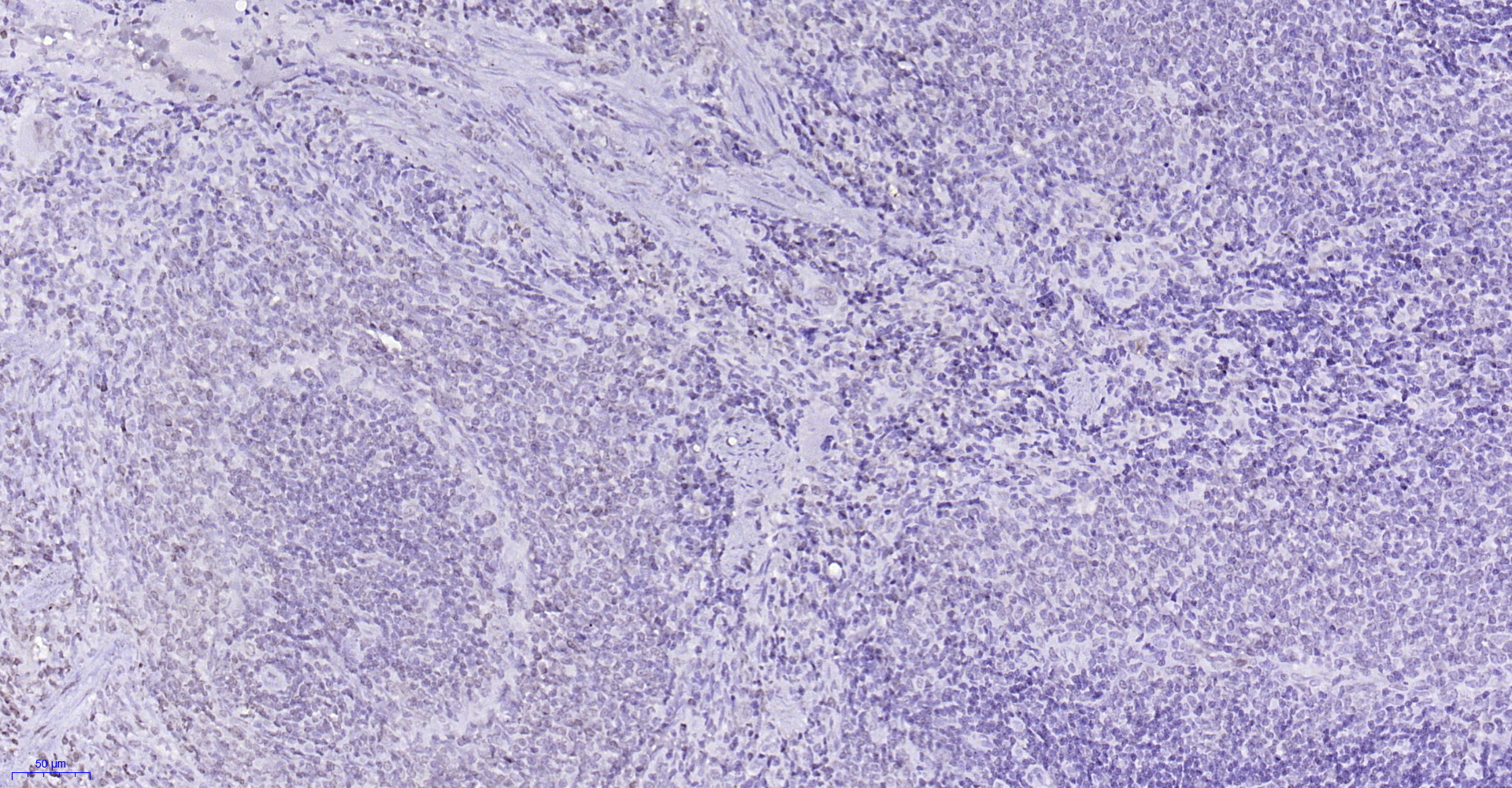 Paraformaldehyde-fixed, paraffin embedded (rat spleen); Antigen retrieval by boiling in sodium citrate buffer (pH6.0) for 15min; Block endogenous peroxidase by 3% hydrogen peroxide for 20 minutes; Blocking buffer (normal goat serum) at 37°C for 30min; Antibody incubation with (RNF113A) Polyclonal Antibody, Unconjugated (bs-9248R) at 1:200 overnight at 4°C, followed by operating according to SP Kit(Rabbit) (sp-0023) instructionsand DAB staining.
