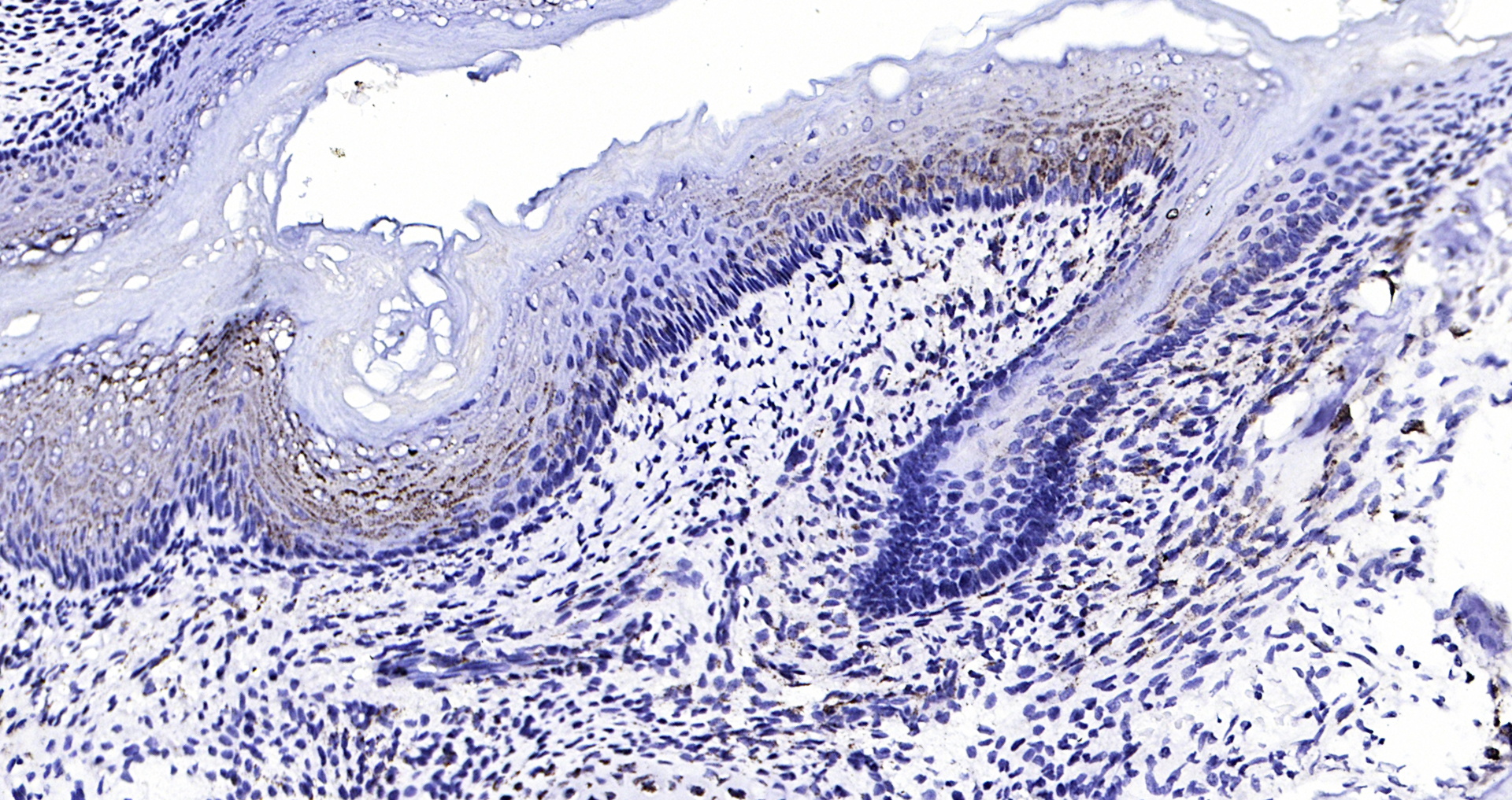 Paraformaldehyde-fixed, paraffin embedded (rat bone); Antigen retrieval by boiling in sodium citrate buffer (pH6.0) for 15min; Block endogenous peroxidase by 3% hydrogen peroxide for 20 minutes; Blocking buffer (normal goat serum) at 37°C for 30min; Antibody incubation with (BMPR1A) Polyclonal Antibody, Unconjugated (bs-1509R) at 1:200 overnight at 4°C, followed by operating according to SP Kit(Rabbit) (sp-0023) instructionsand DAB staining.