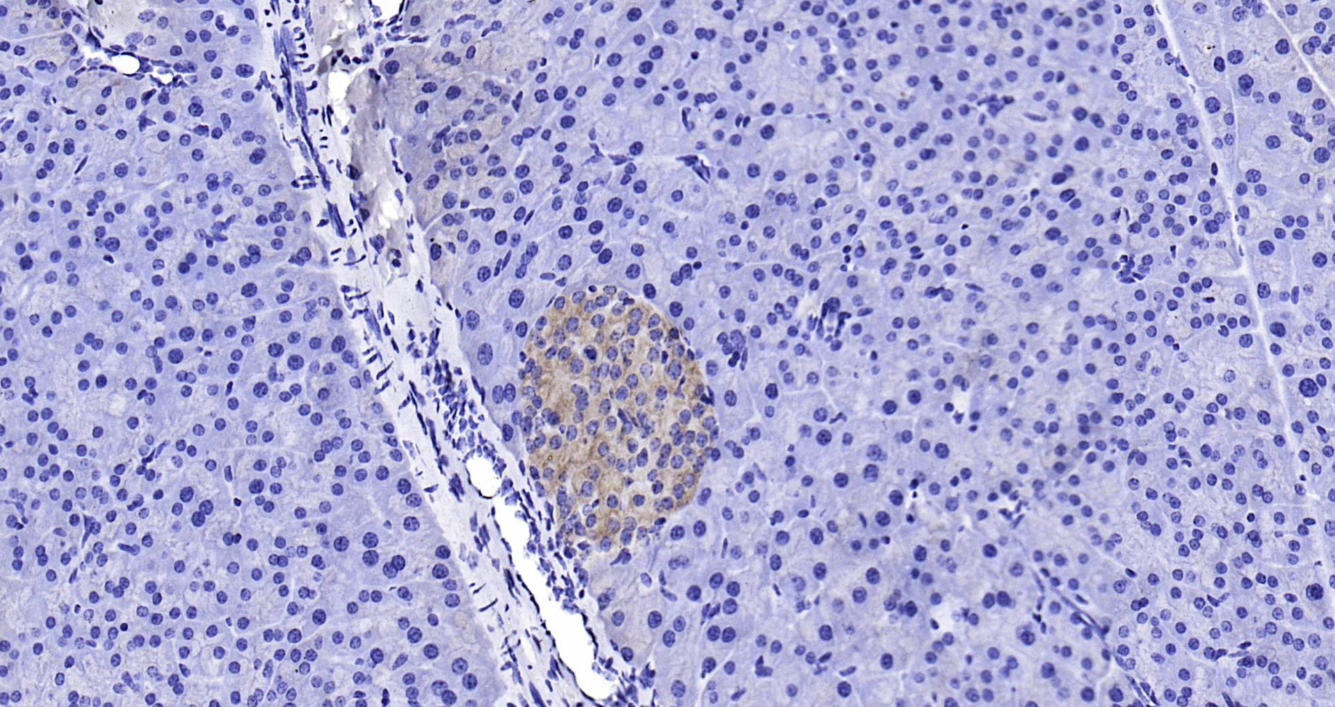 Paraformaldehyde-fixed, paraffin embedded (rat pancreas); Antigen retrieval by boiling in sodium citrate buffer (pH6.0) for 15min; Block endogenous peroxidase by 3% hydrogen peroxide for 20 minutes; Blocking buffer (normal goat serum) at 37°C for 30min; Antibody incubation with (BMPR1A) Polyclonal Antibody, Unconjugated (bs-1509R) at 1:200 overnight at 4°C, followed by operating according to SP Kit(Rabbit) (sp-0023) instructionsand DAB staining.