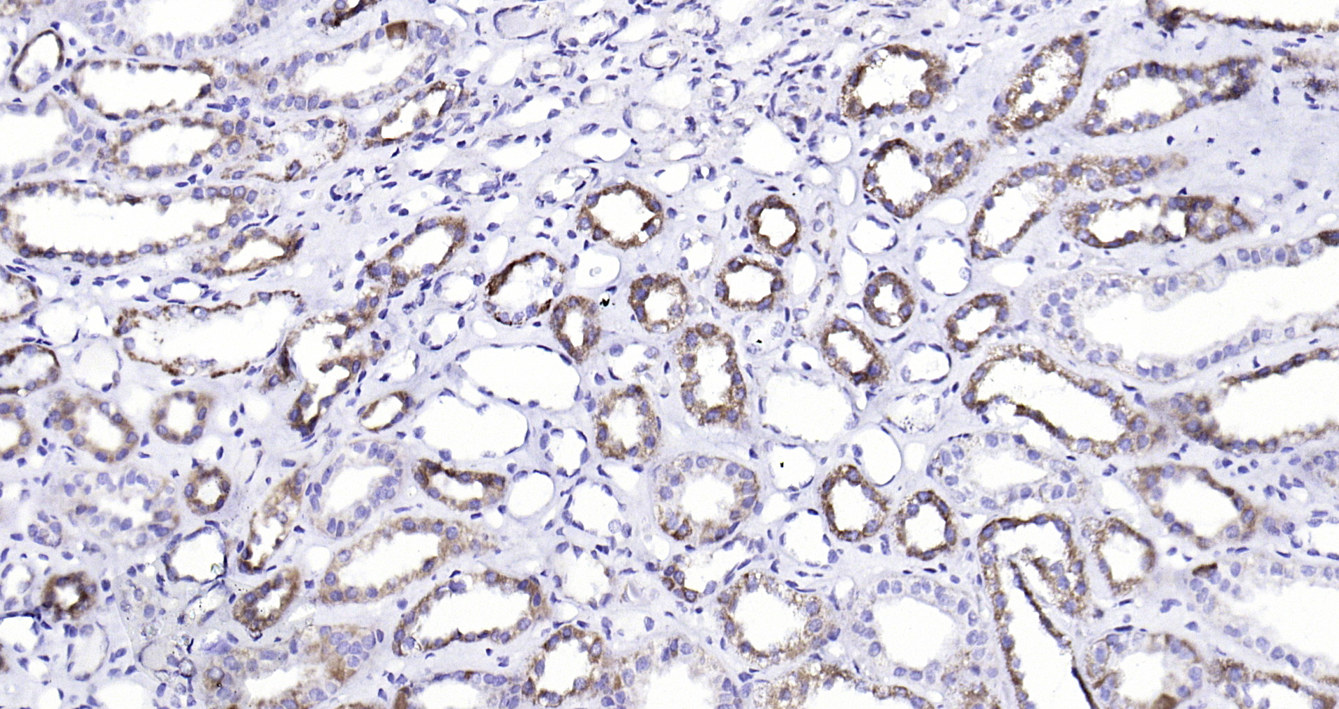 Paraformaldehyde-fixed, paraffin embedded (human kidney ); Antigen retrieval by boiling in sodium citrate buffer (pH6.0) for 15min; Block endogenous peroxidase by 3% hydrogen peroxide for 20 minutes; Blocking buffer (normal goat serum) at 37°C for 30min; Antibody incubation with (BMPR1A) Polyclonal Antibody, Unconjugated (bs-1509R) at 1:200 overnight at 4°C, followed by operating according to SP Kit(Rabbit) (sp-0023) instructionsand DAB staining.